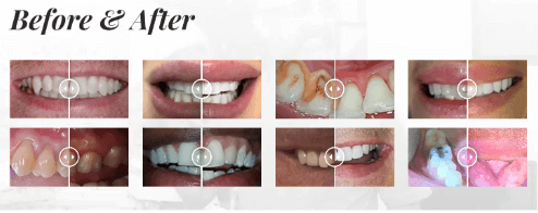 Dental before and after photos