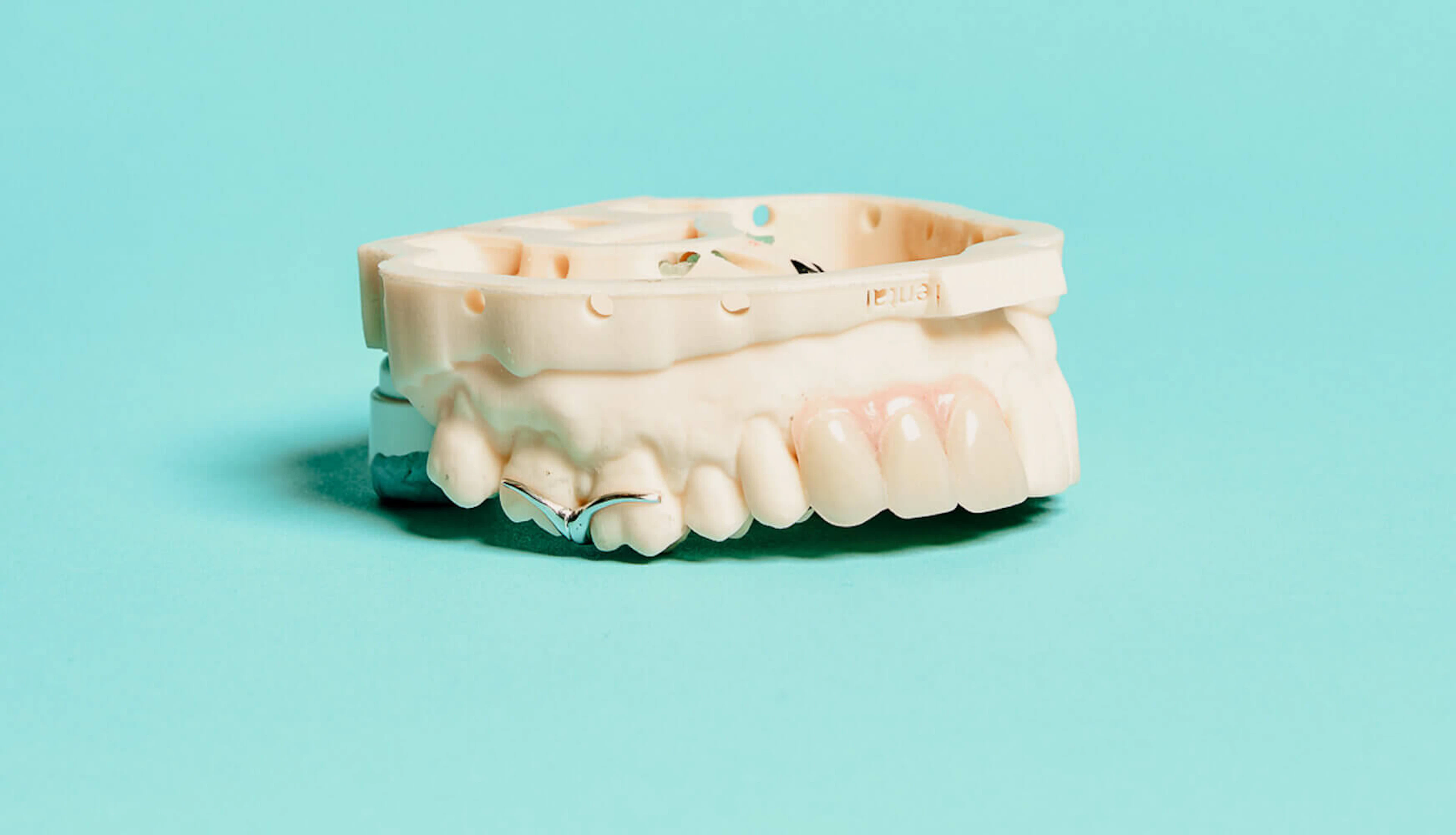 digital dentures access
