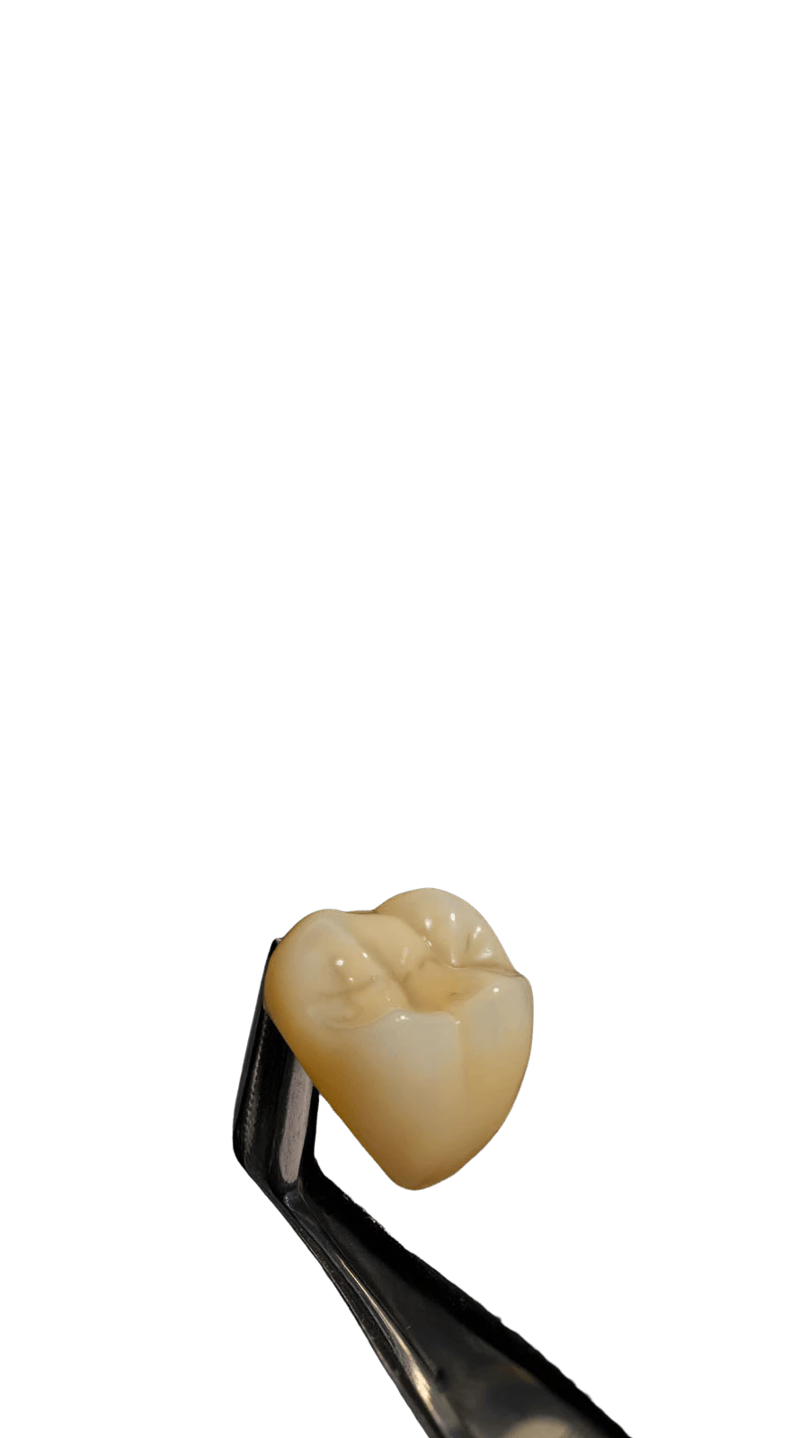 Posterior crown