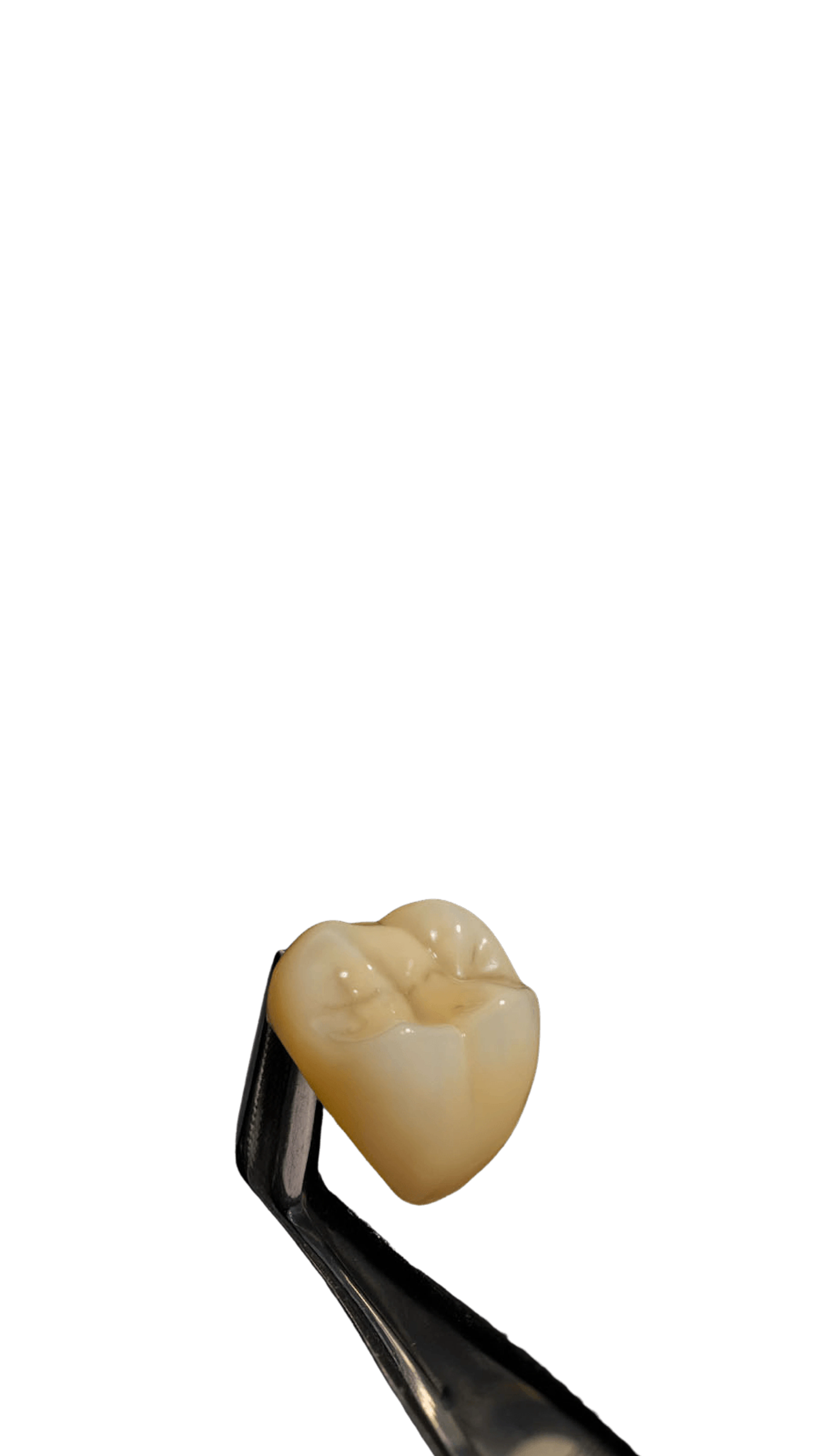 Posterior crown