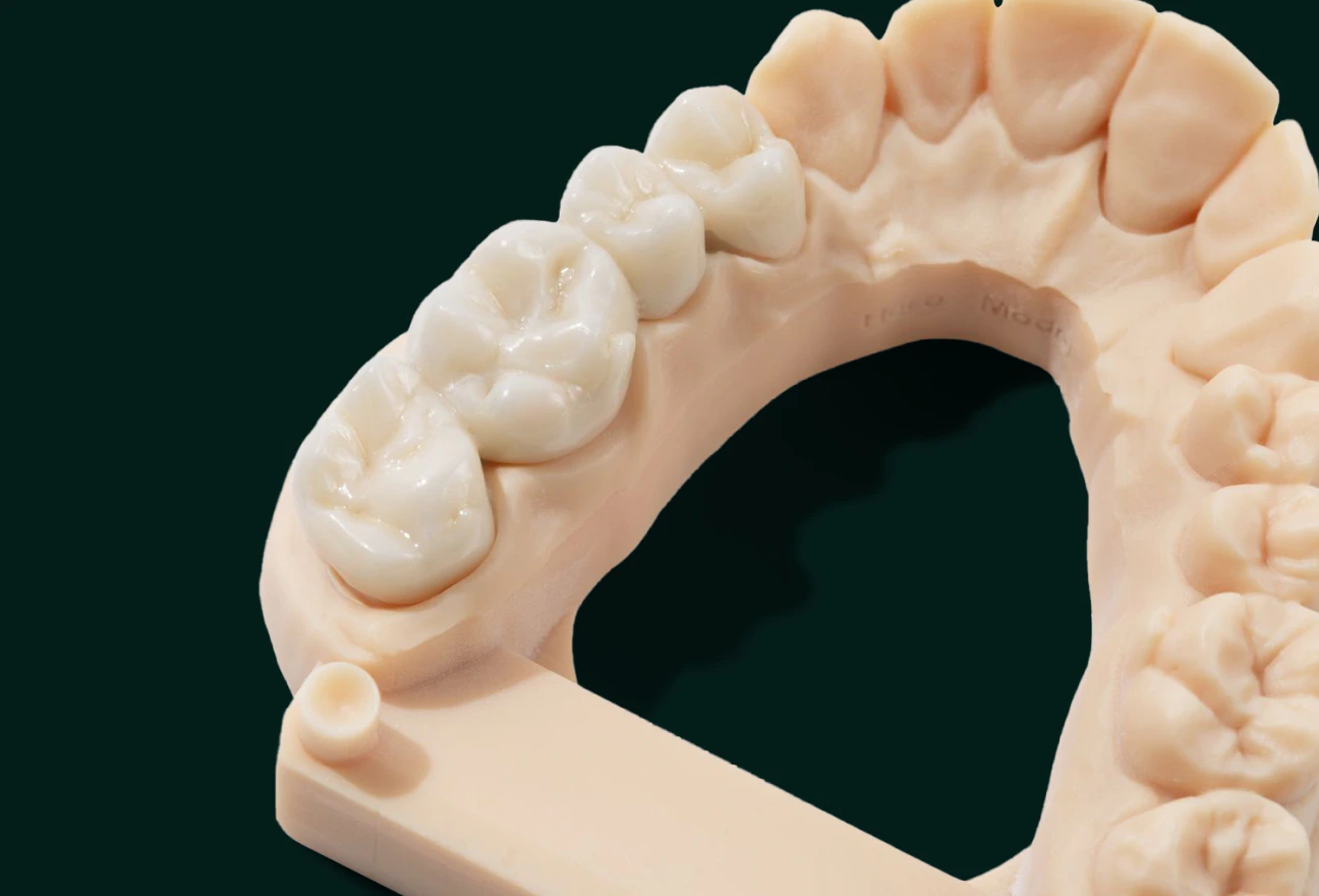 Crown and bridge dental model on a lab tray