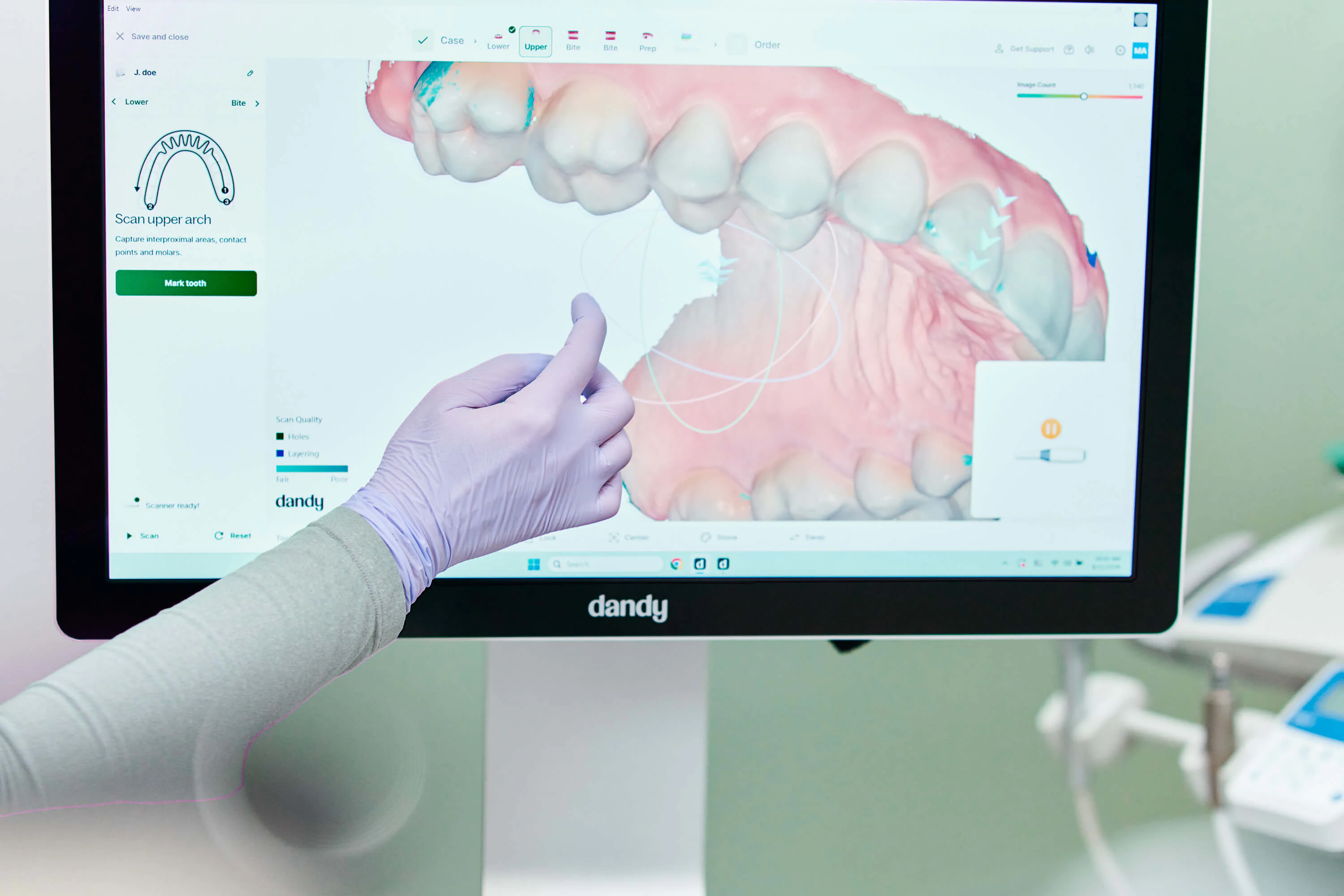 Dandy Vision Scanner