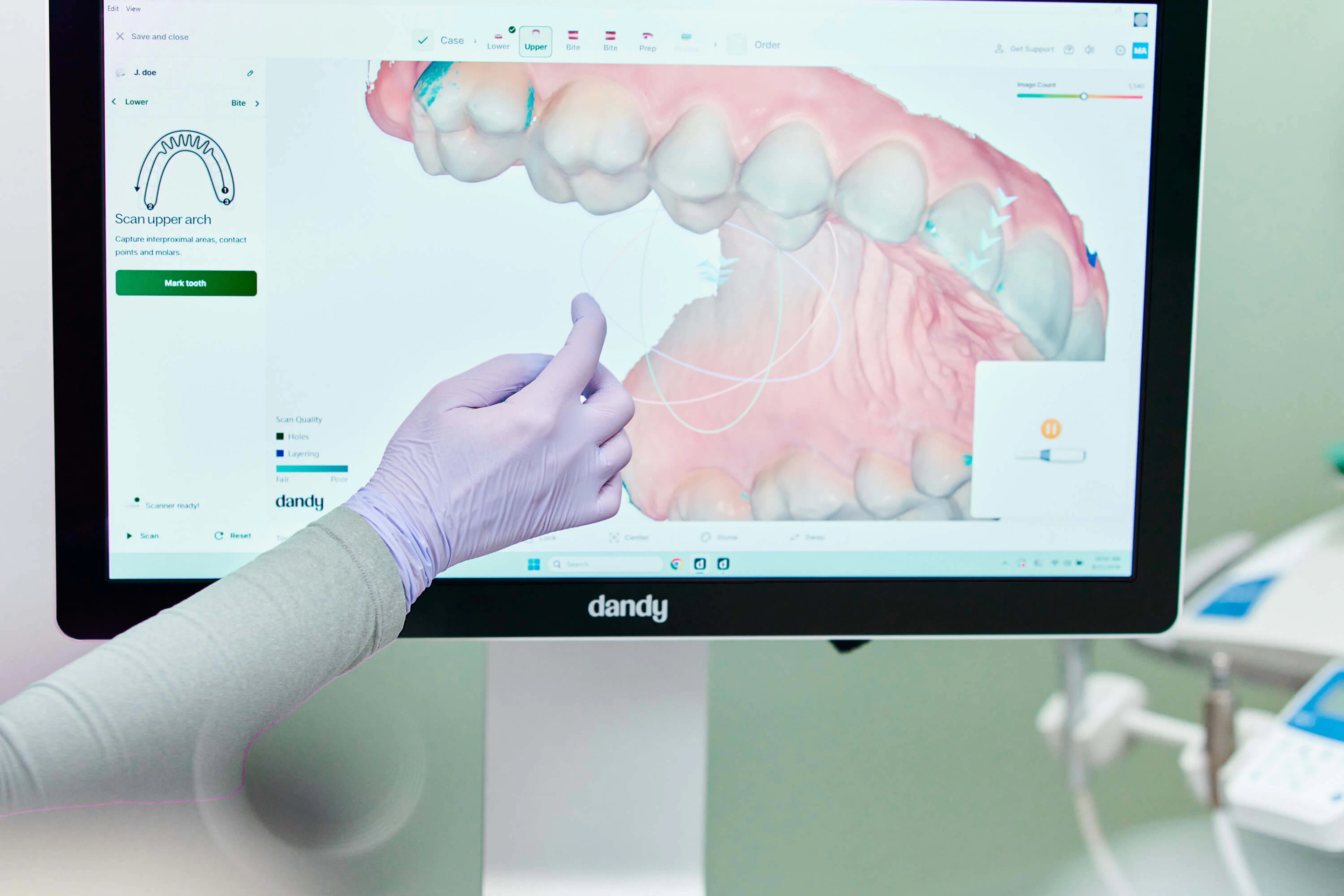 Dandy Vision Scanner