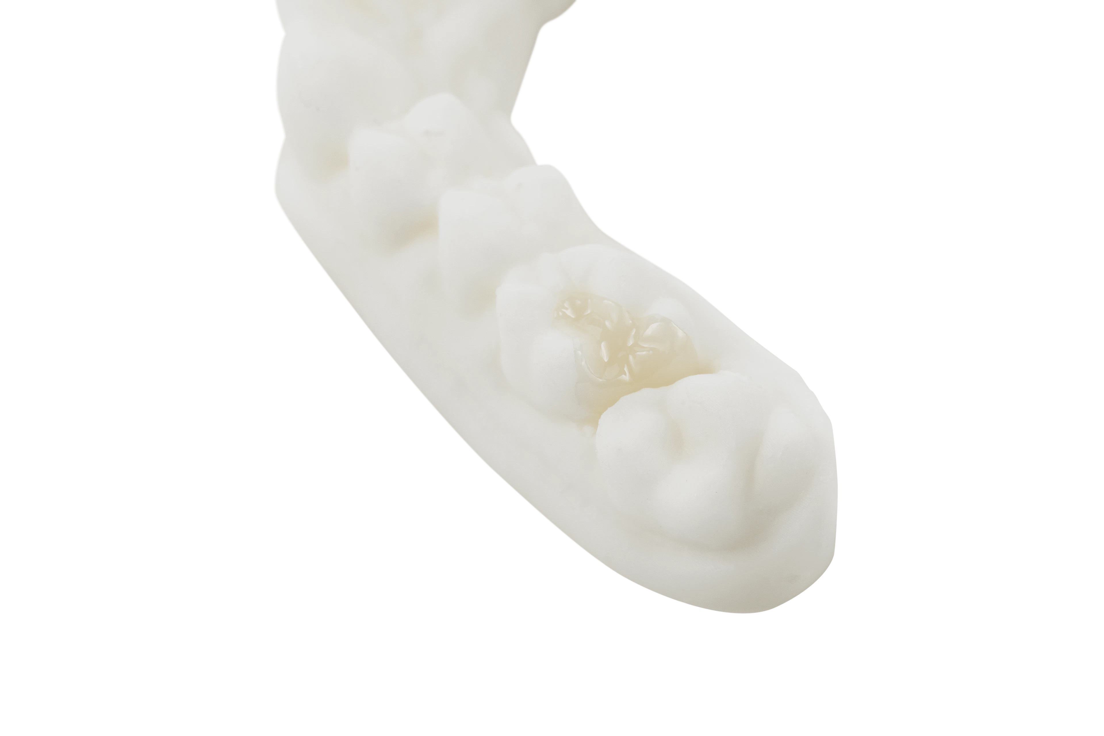 Full Intended Use of Full Contour Lithium Disilicate (IPS E.Max)