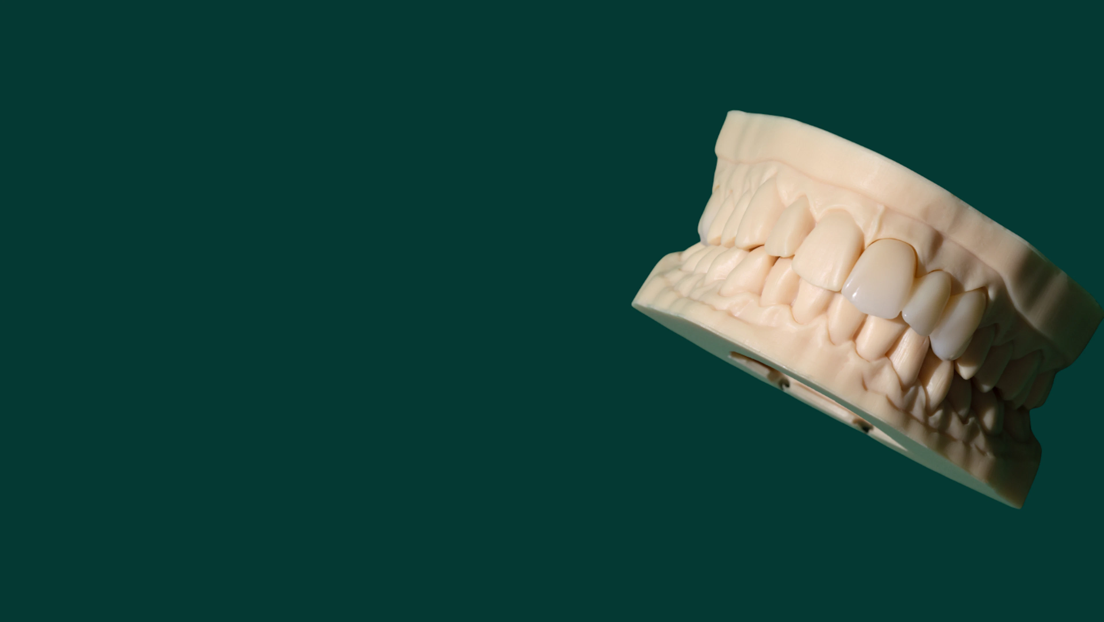 Anterior crown and bridge hero