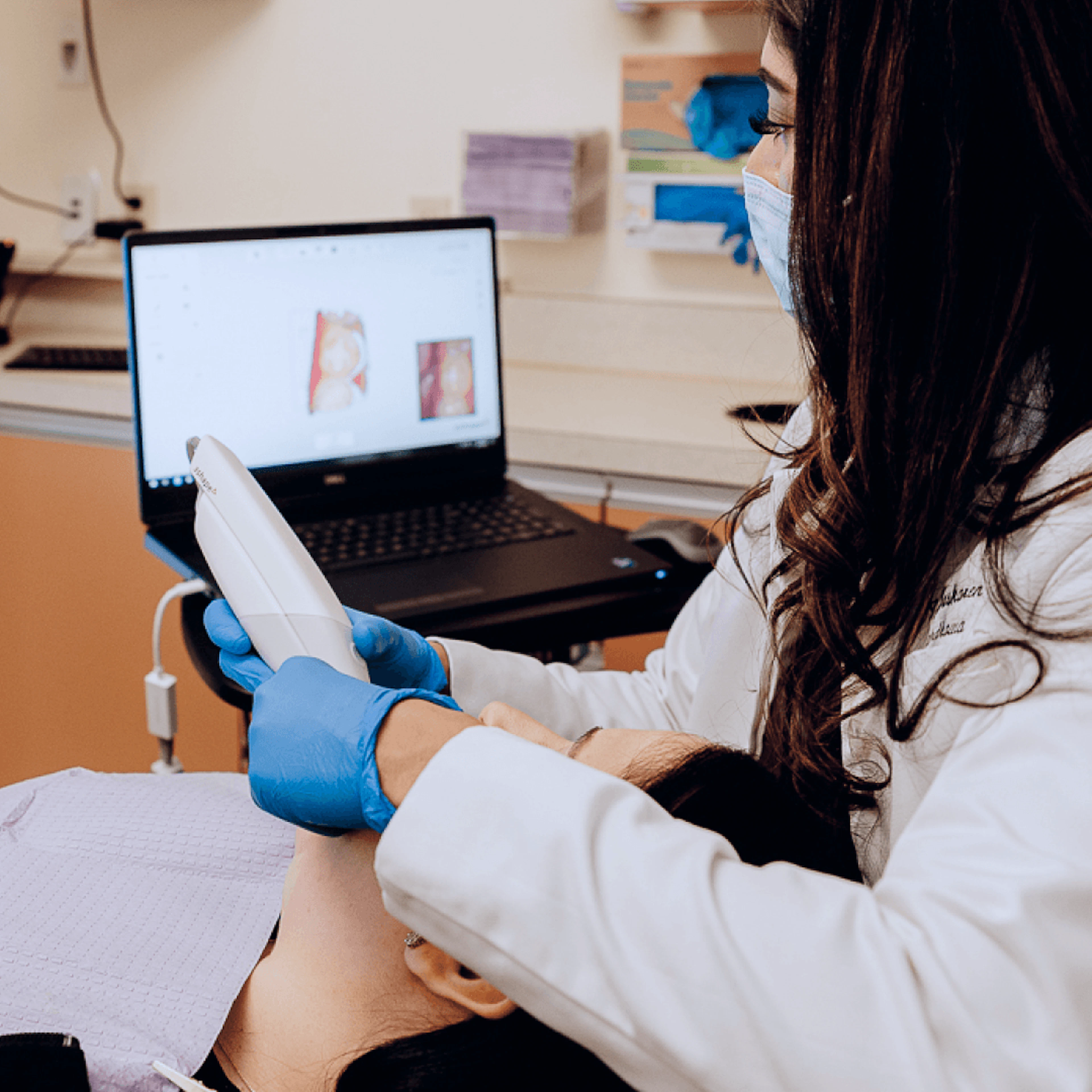 Scanning preparation