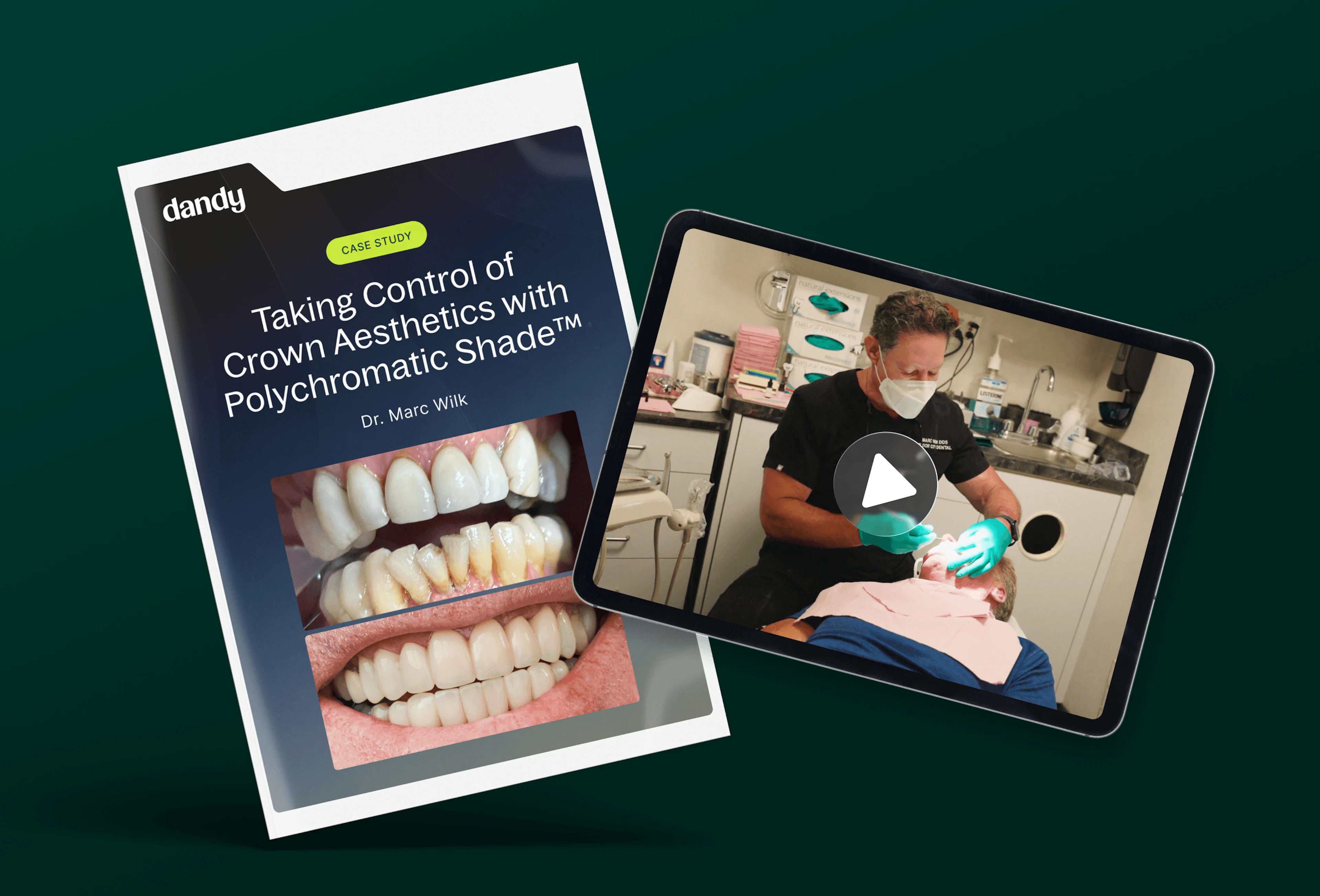 Taking Control of Crown Aesthetics with Polychromatic Shade cover
