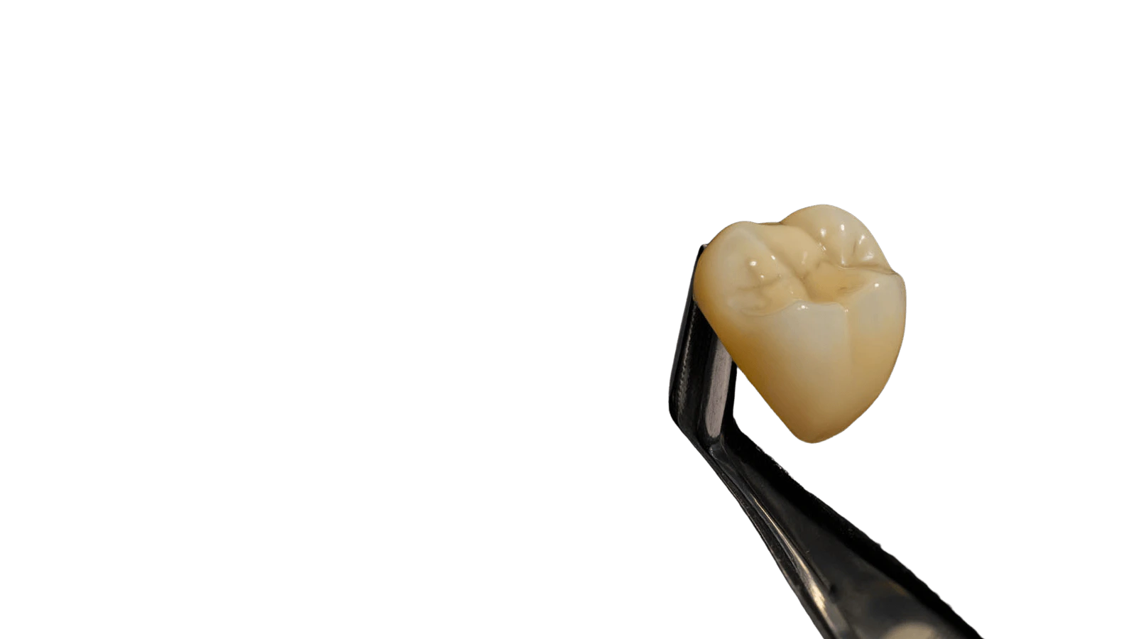 Posterior crown