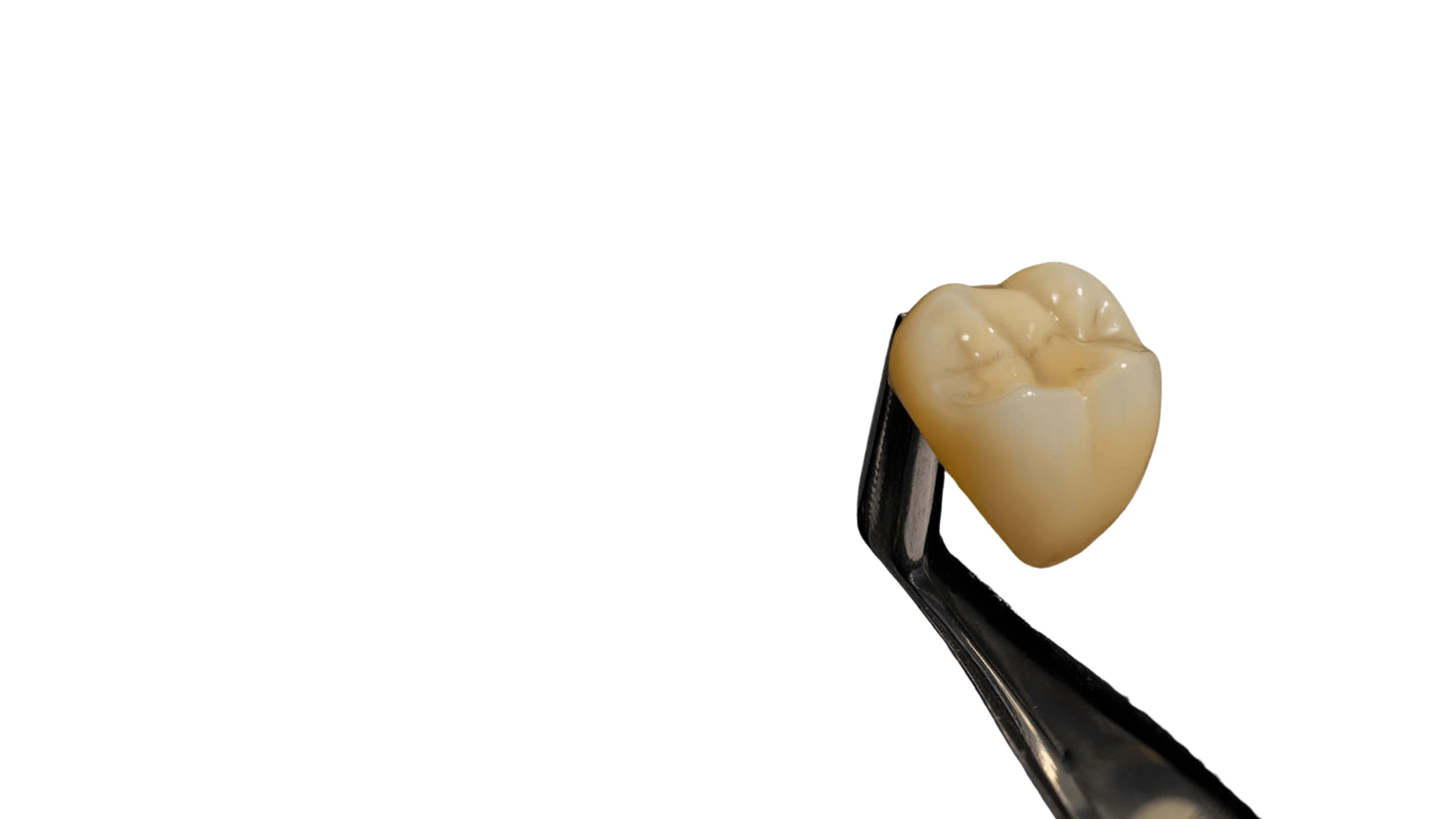 Posterior crown