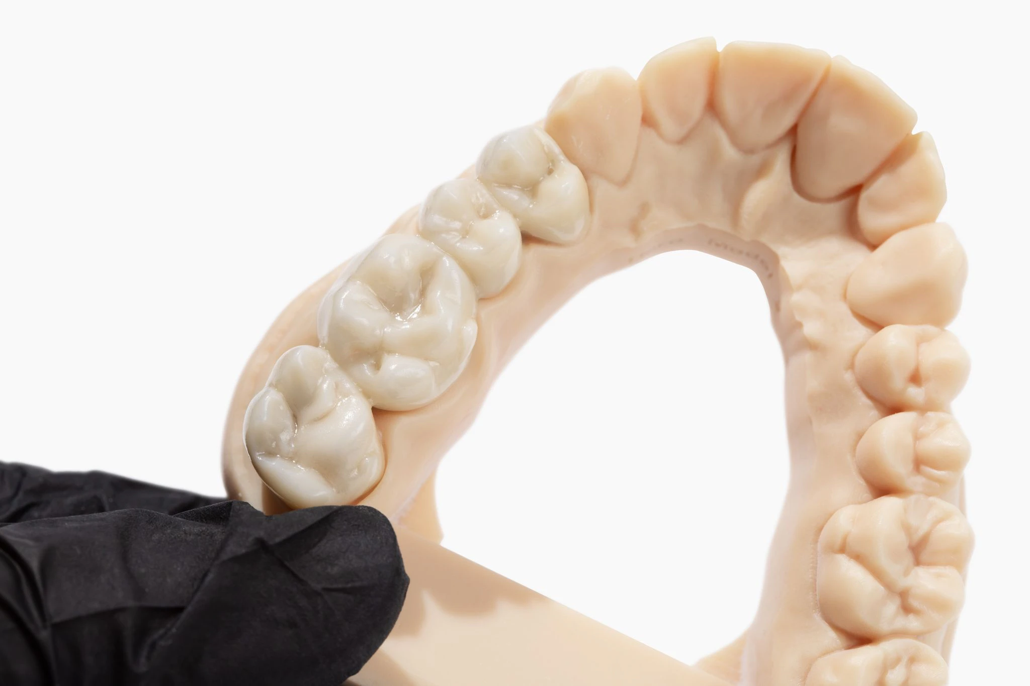 Monolithic zirconia crown on a dental model