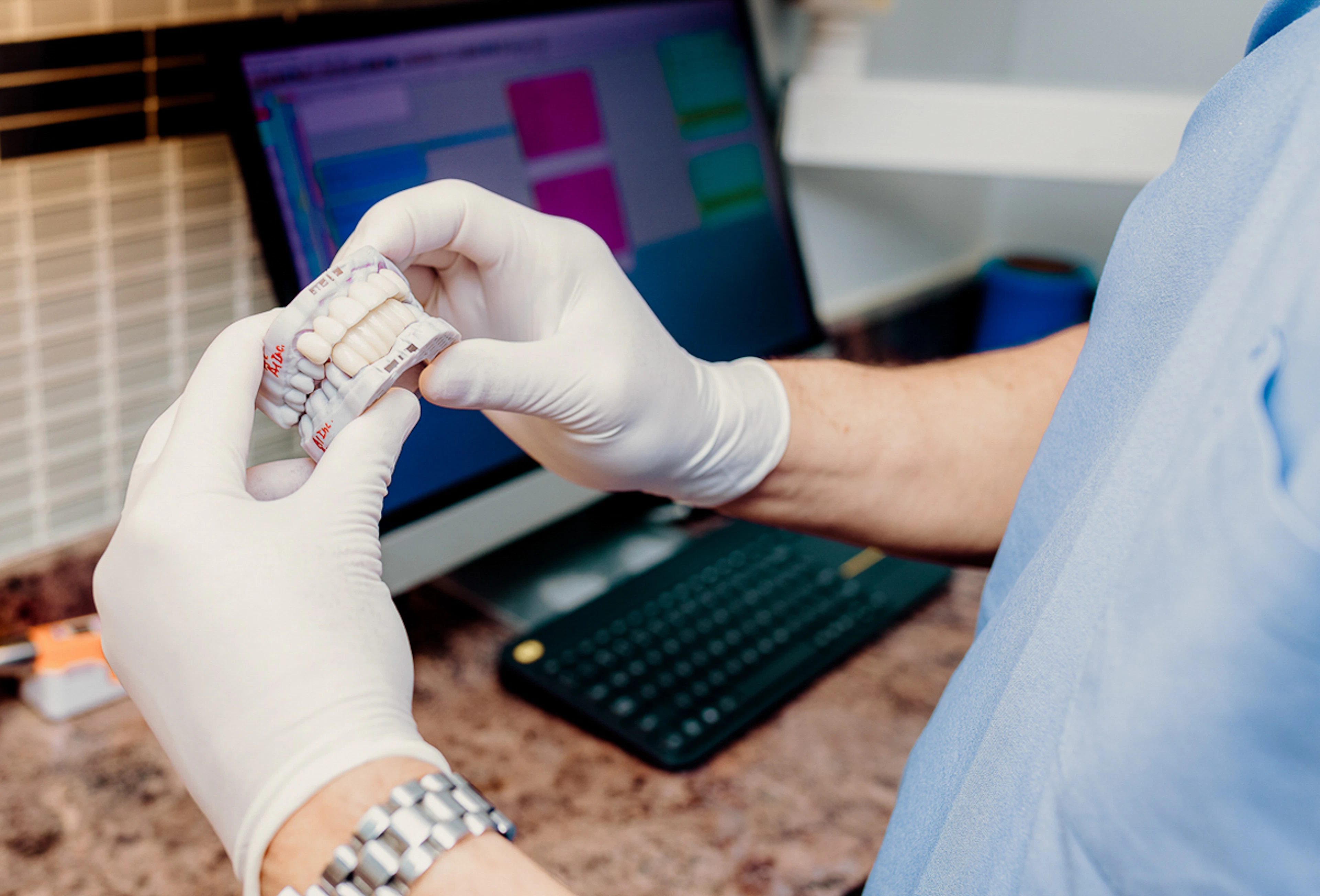 Digital dental models