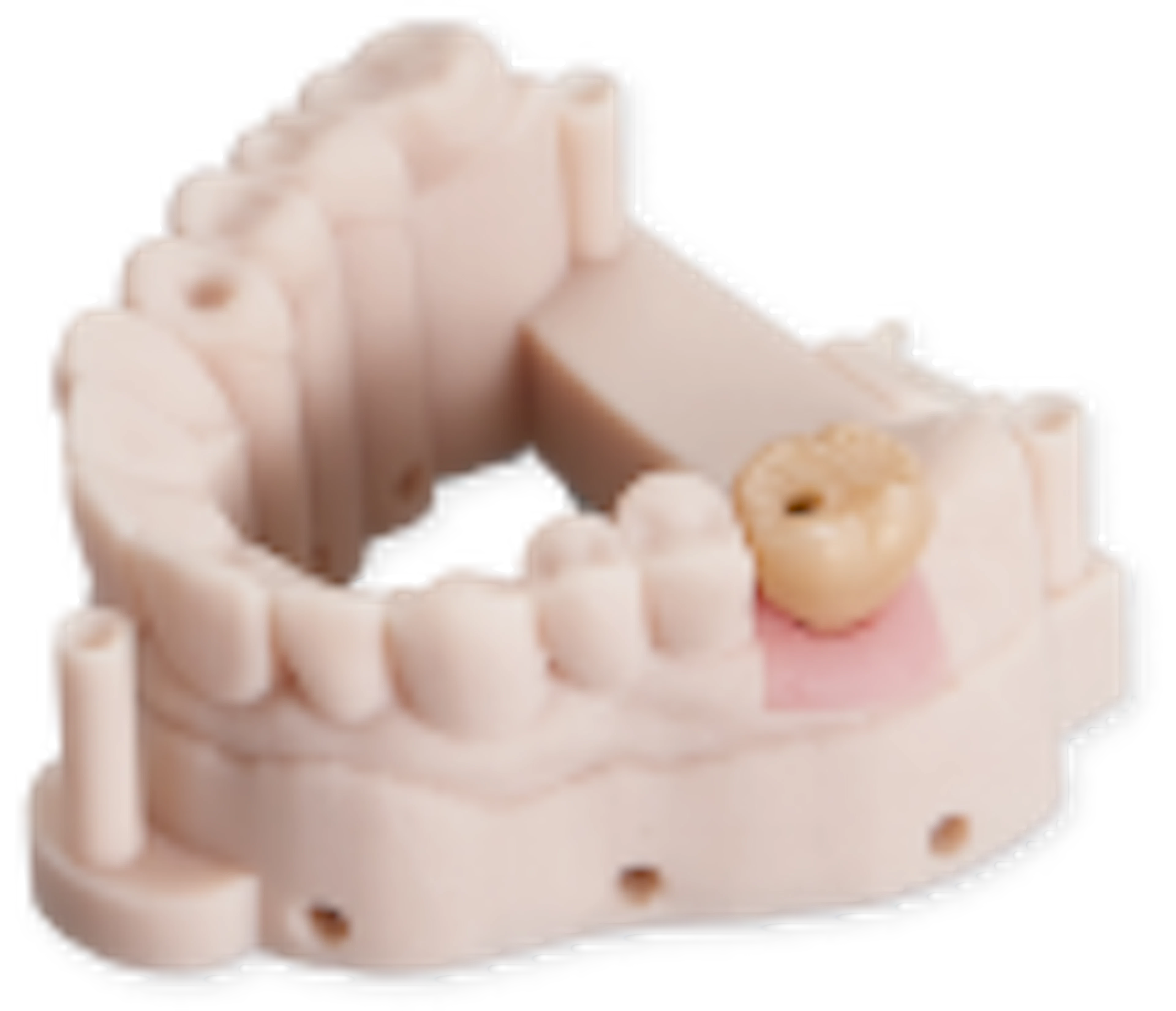 Implant Solutions
