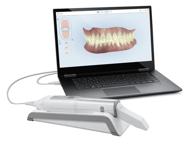 Itero element intraoral scanner