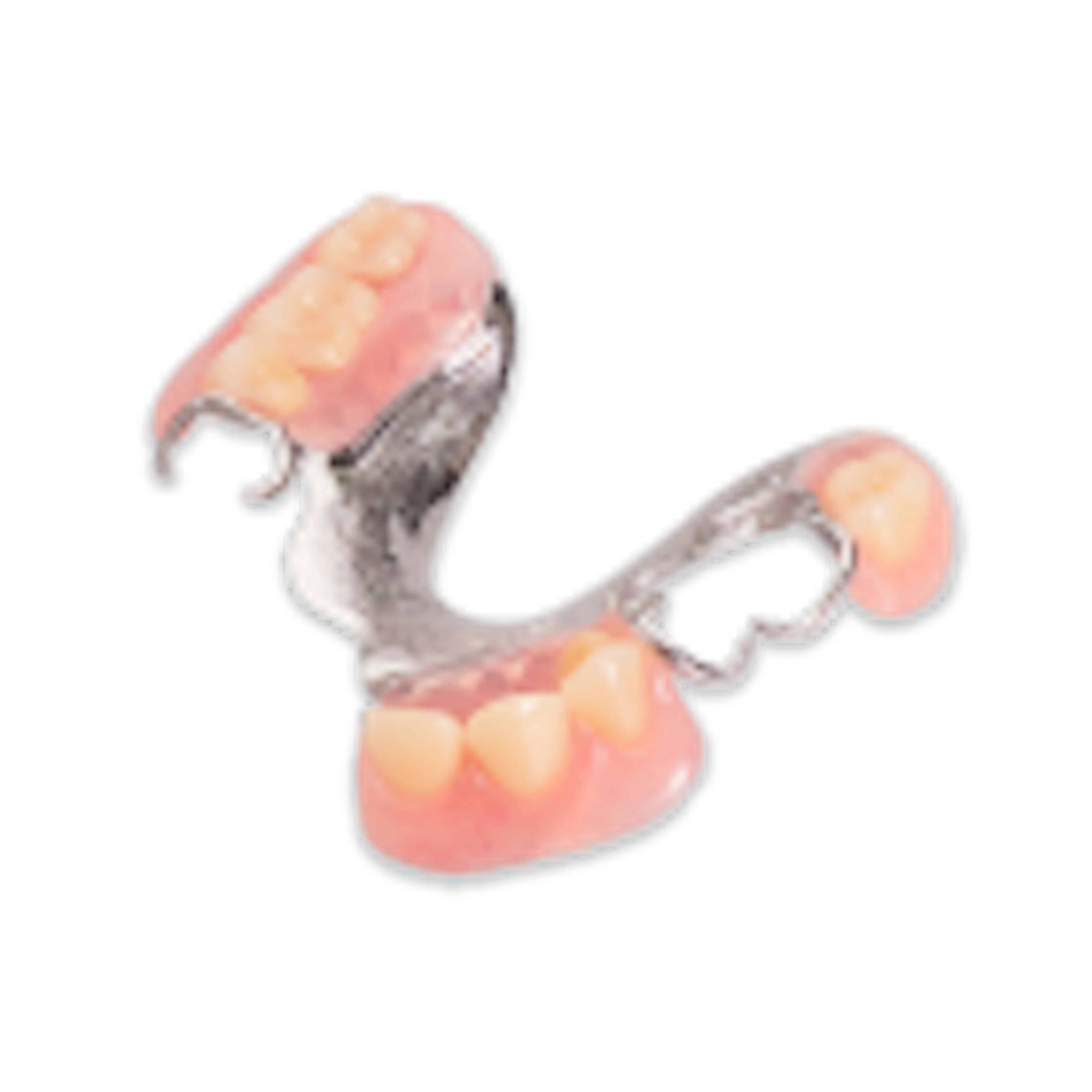Partial Dentures