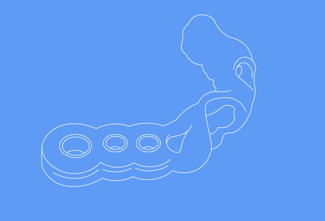 Implant Surgery