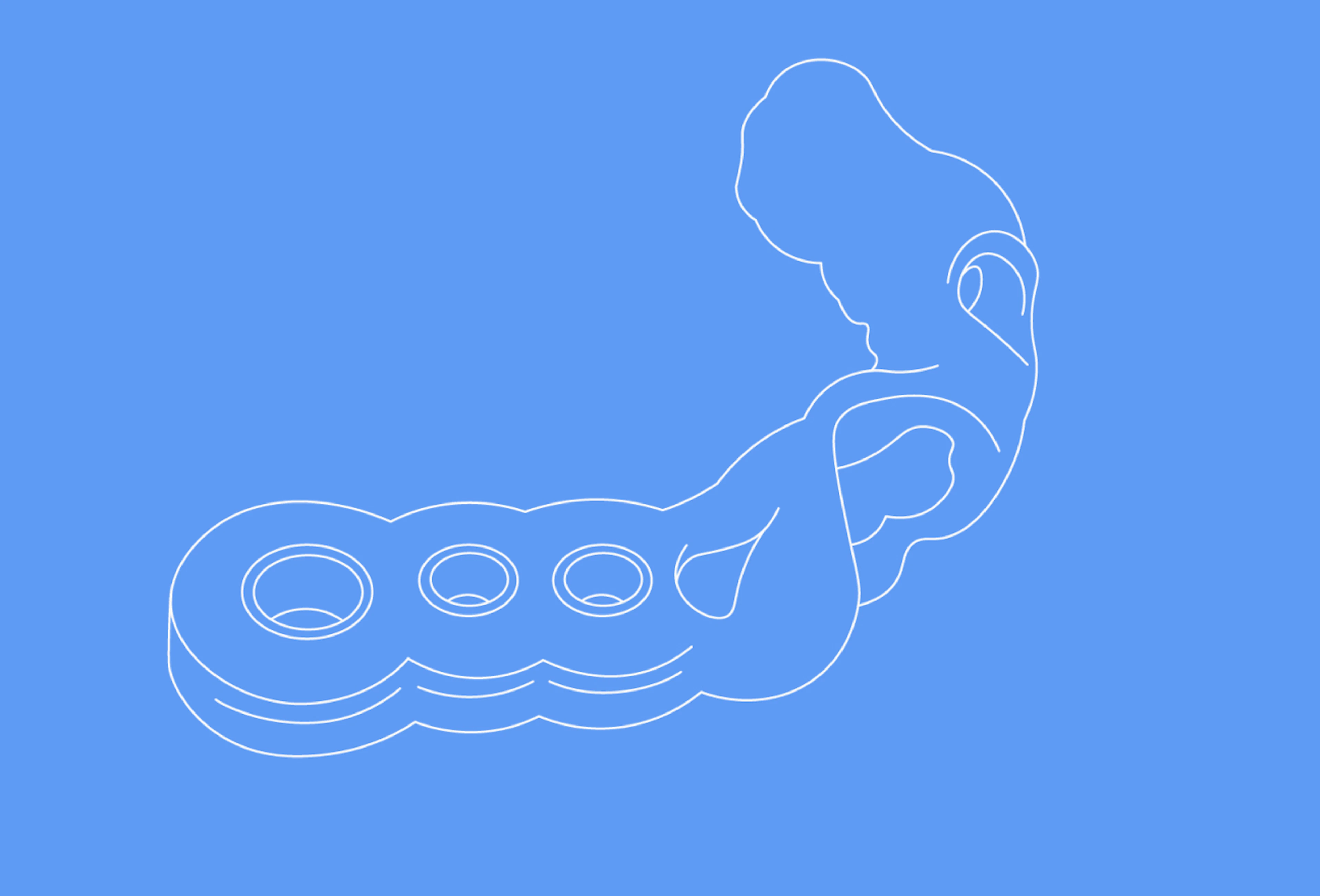 Implant Surgery