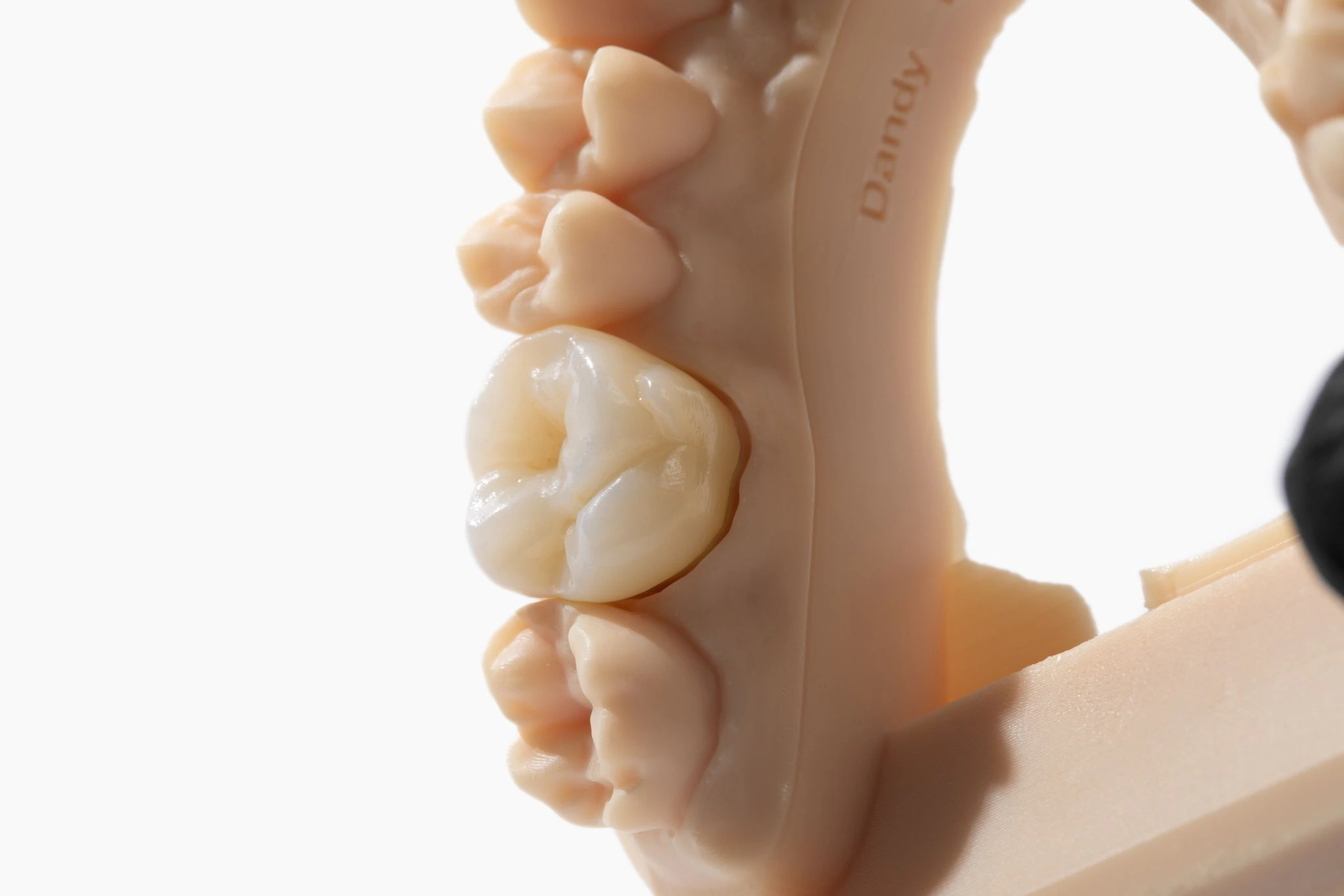 dandy crown aesthetic zirconia