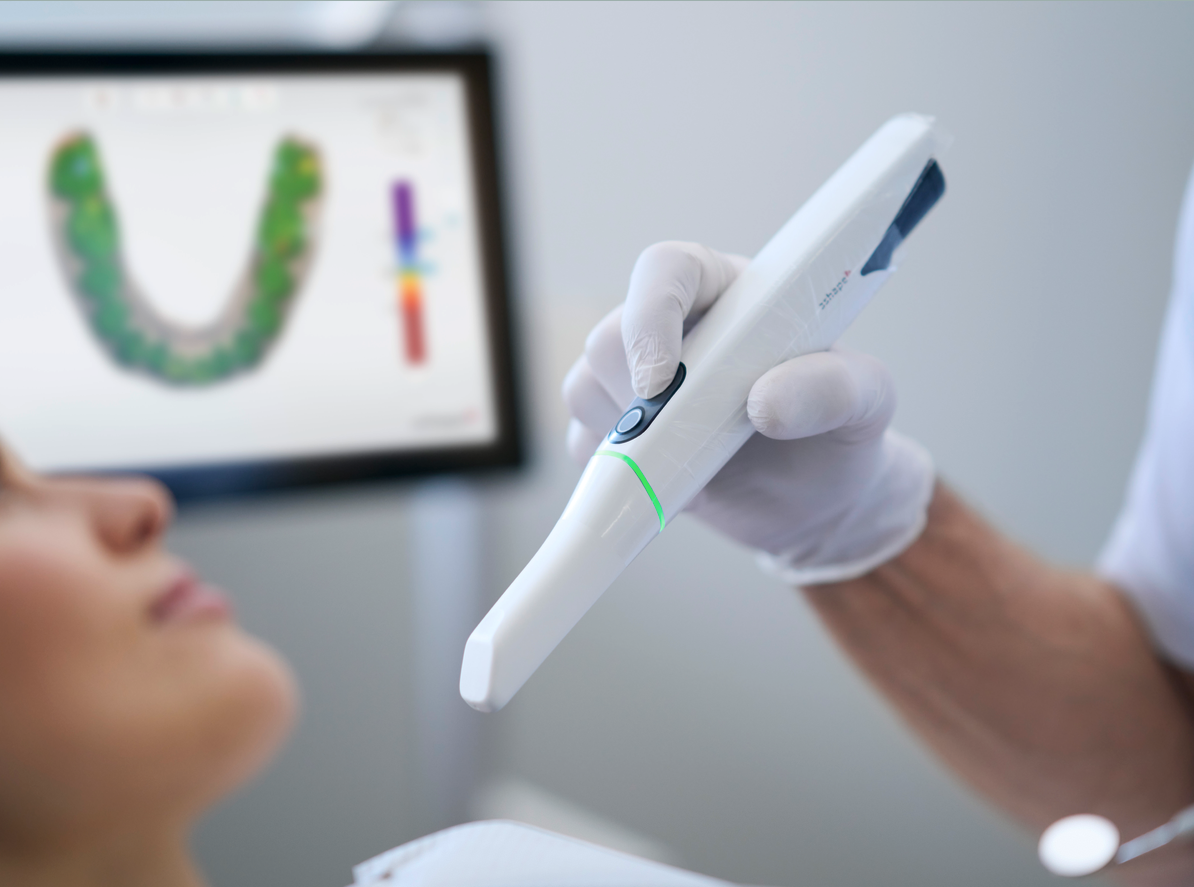 intraoral scanner