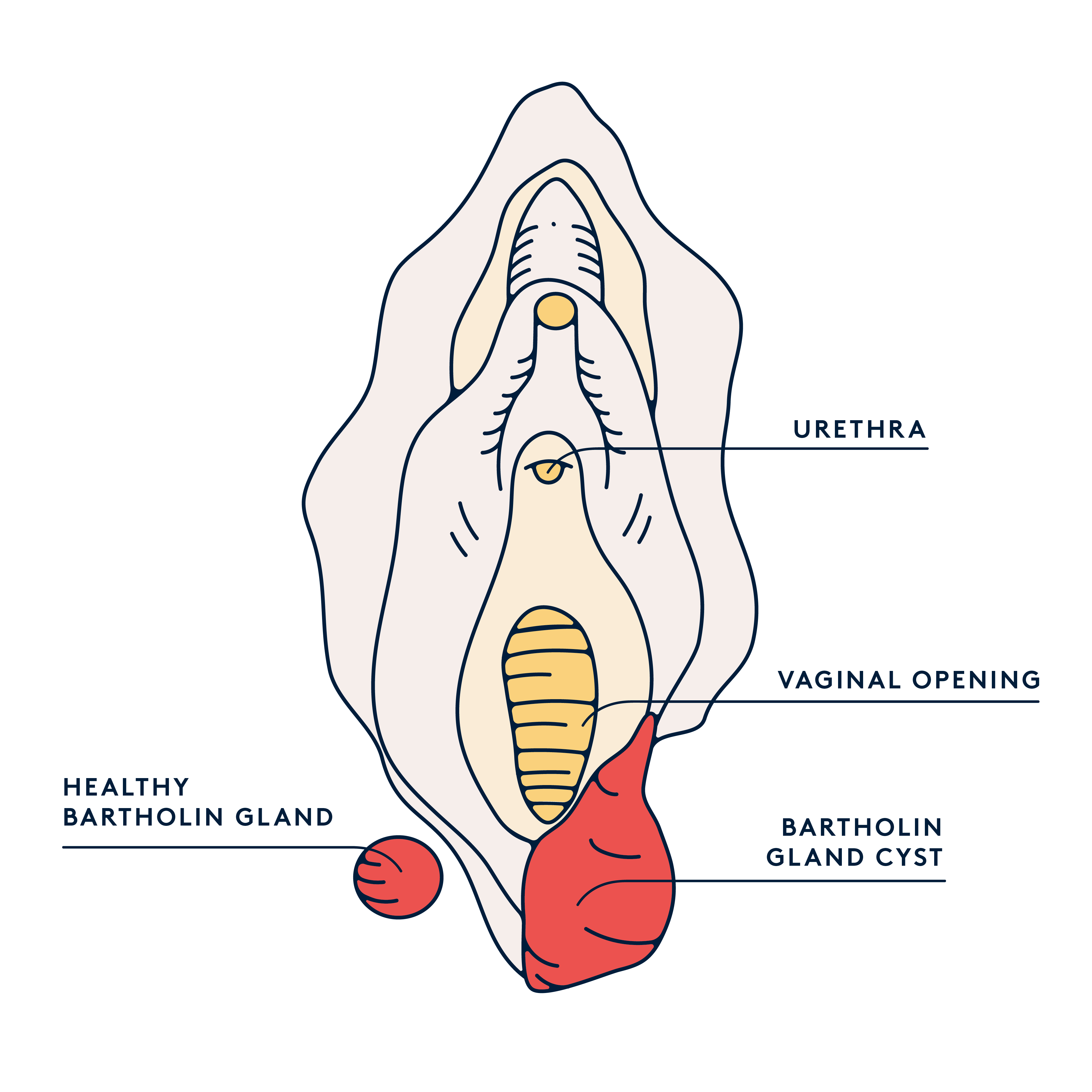 Swollen vulva
