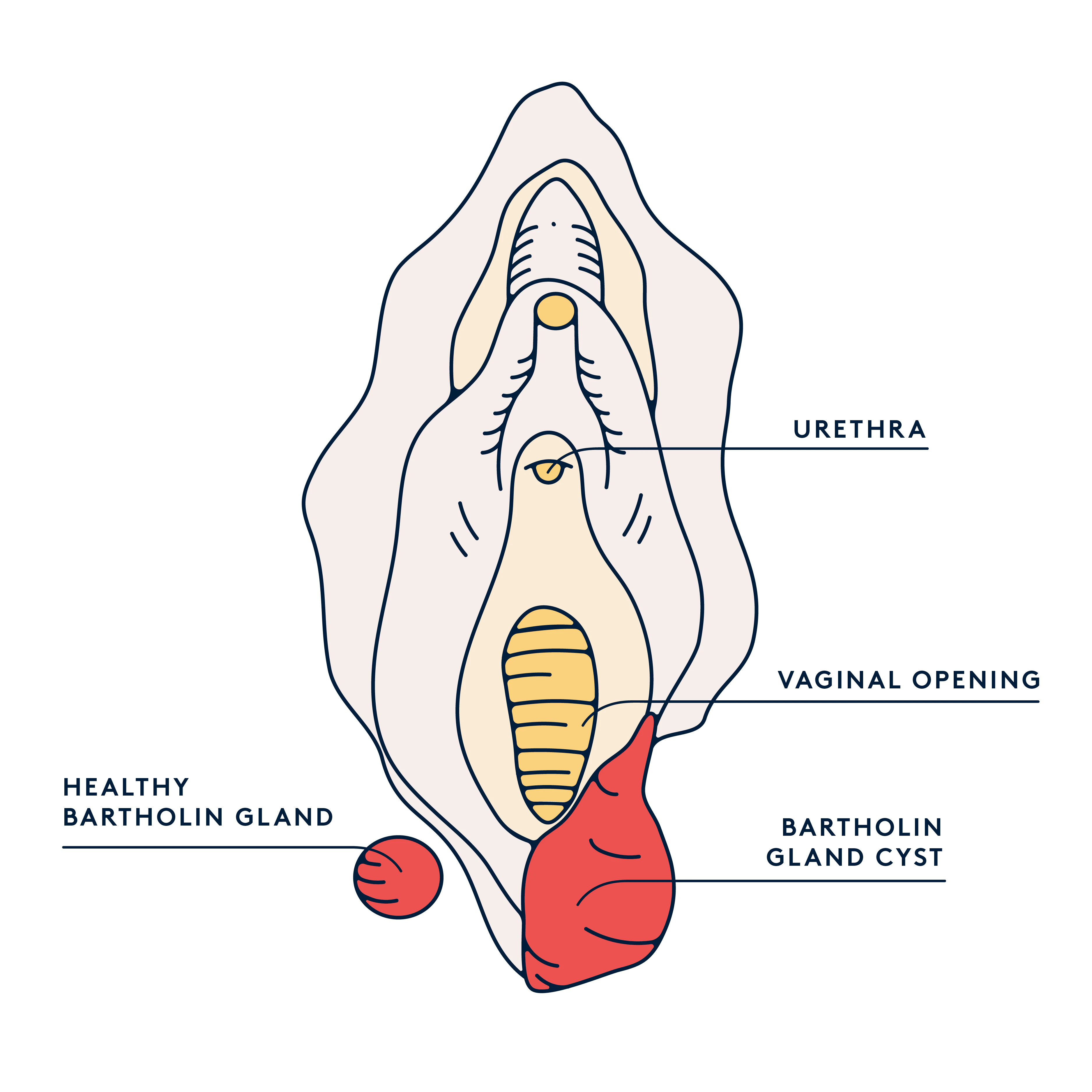 Swollen vulva