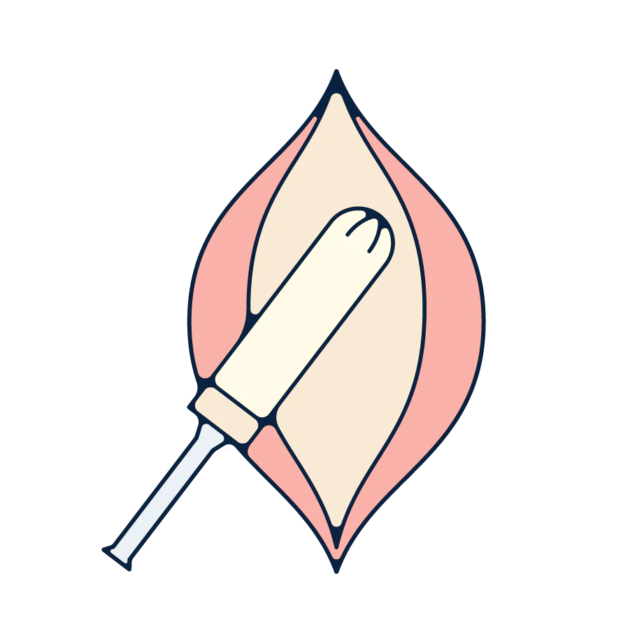 A tampon being inserted into a vagina.