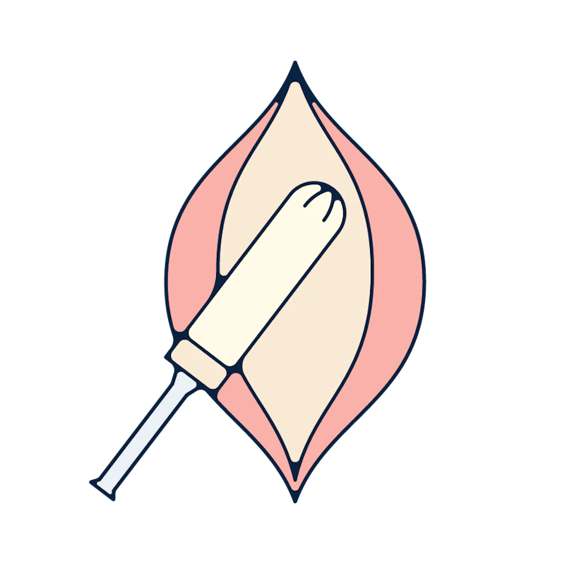 A tampon being inserted into a vagina.