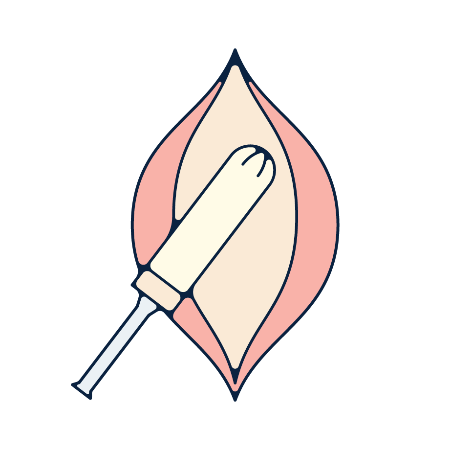A tampon being inserted into a vagina.