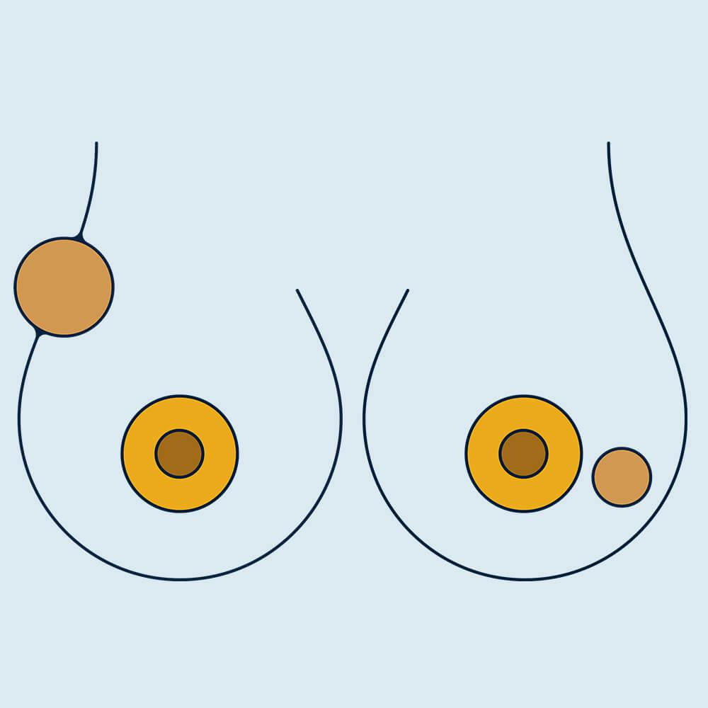 6 Things To Do For Great Breasts: From Skincare To Breast Checks