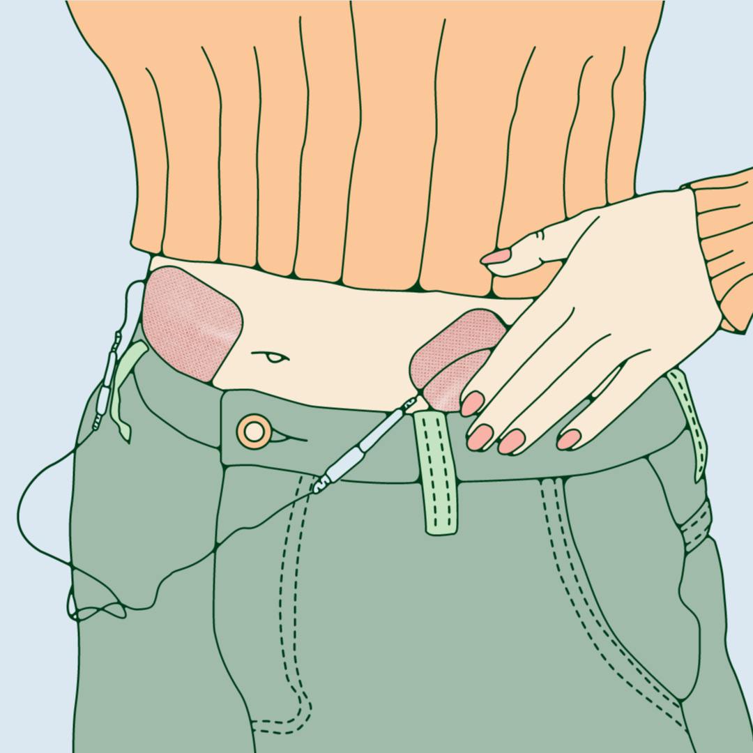 Another day, another potential remedy for period pain.