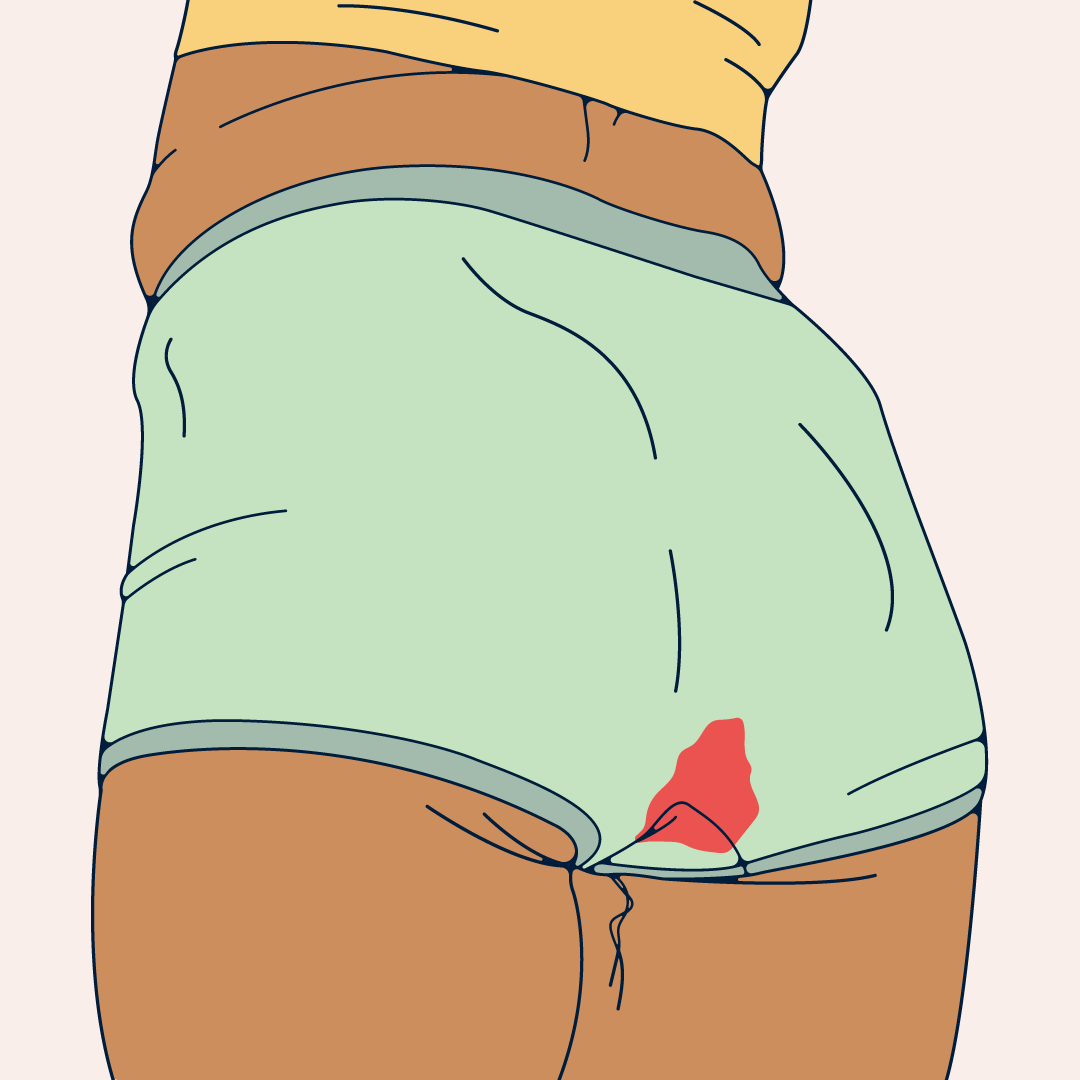 A person with a period stain on their underwear.