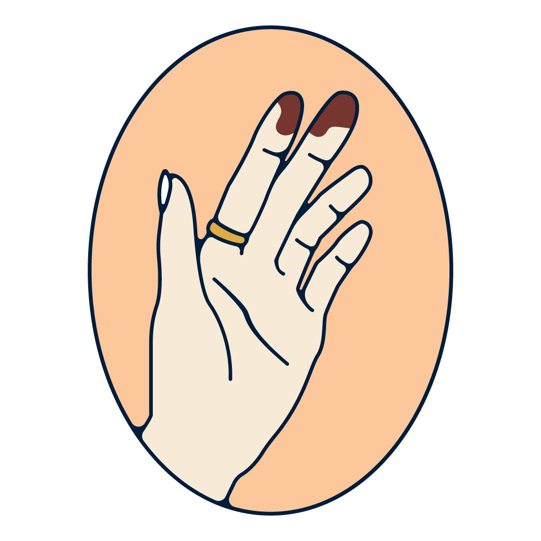 A human hand with a brown vaginal discharge on the fingers.