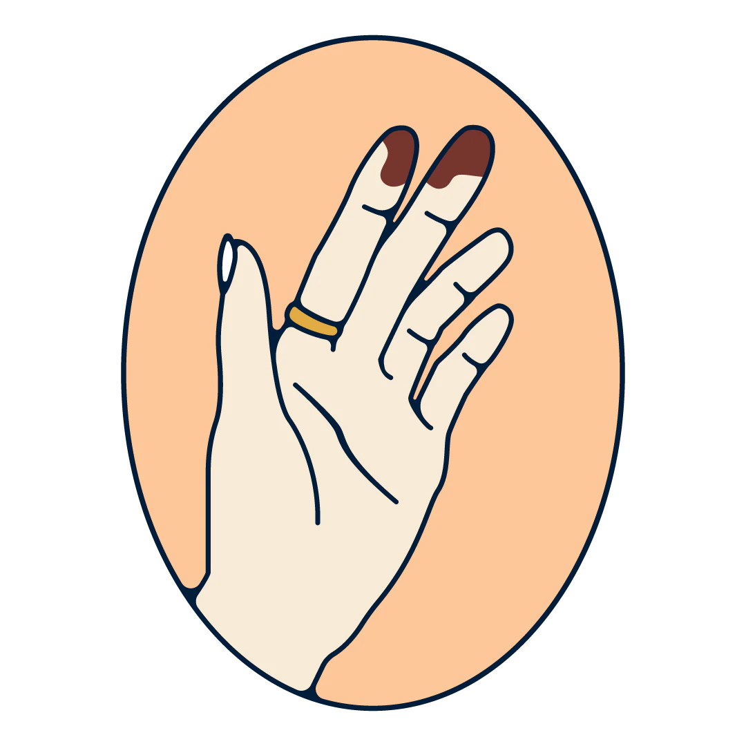 A human hand with a brown vaginal discharge on the fingers.