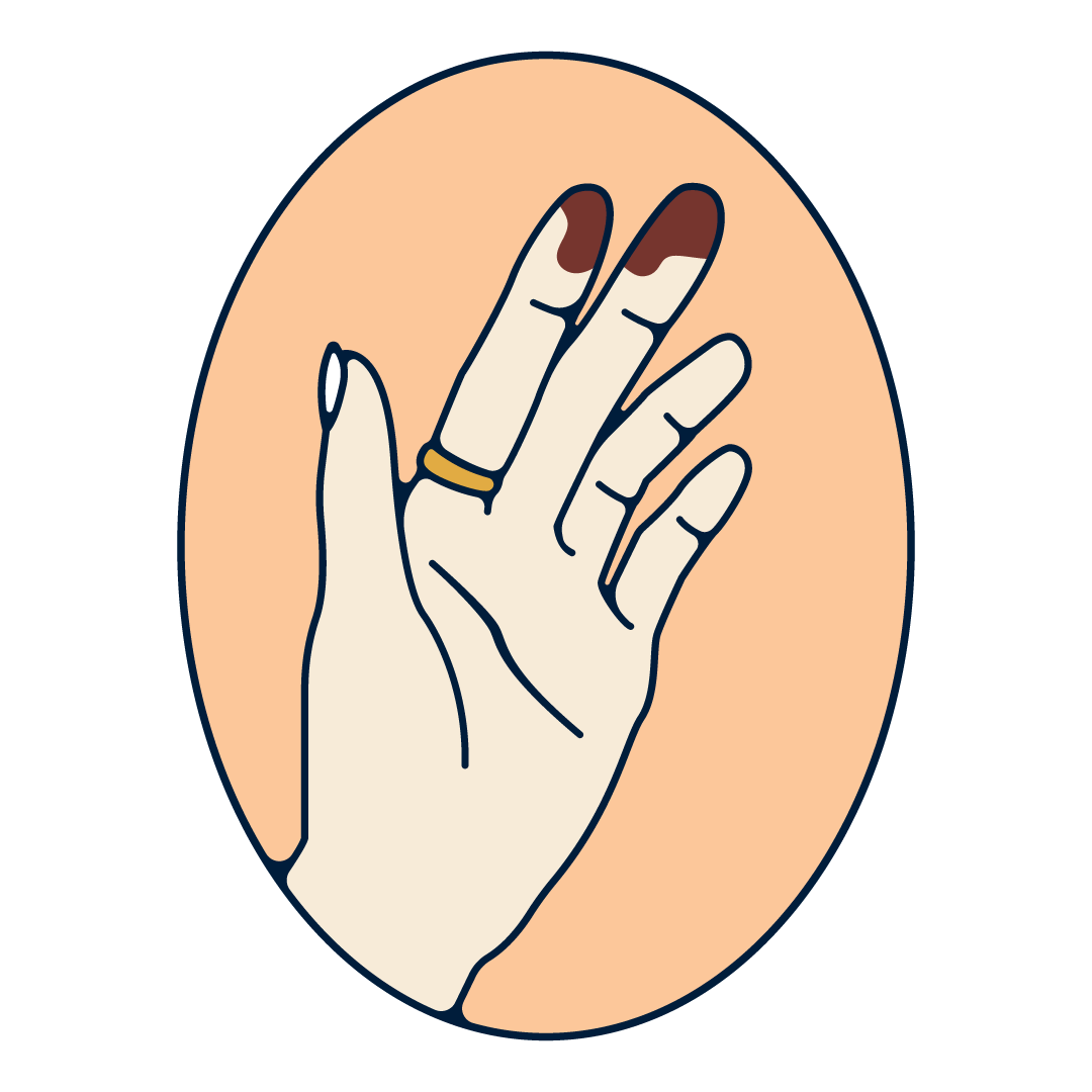 A human hand with a brown vaginal discharge on the fingers. 