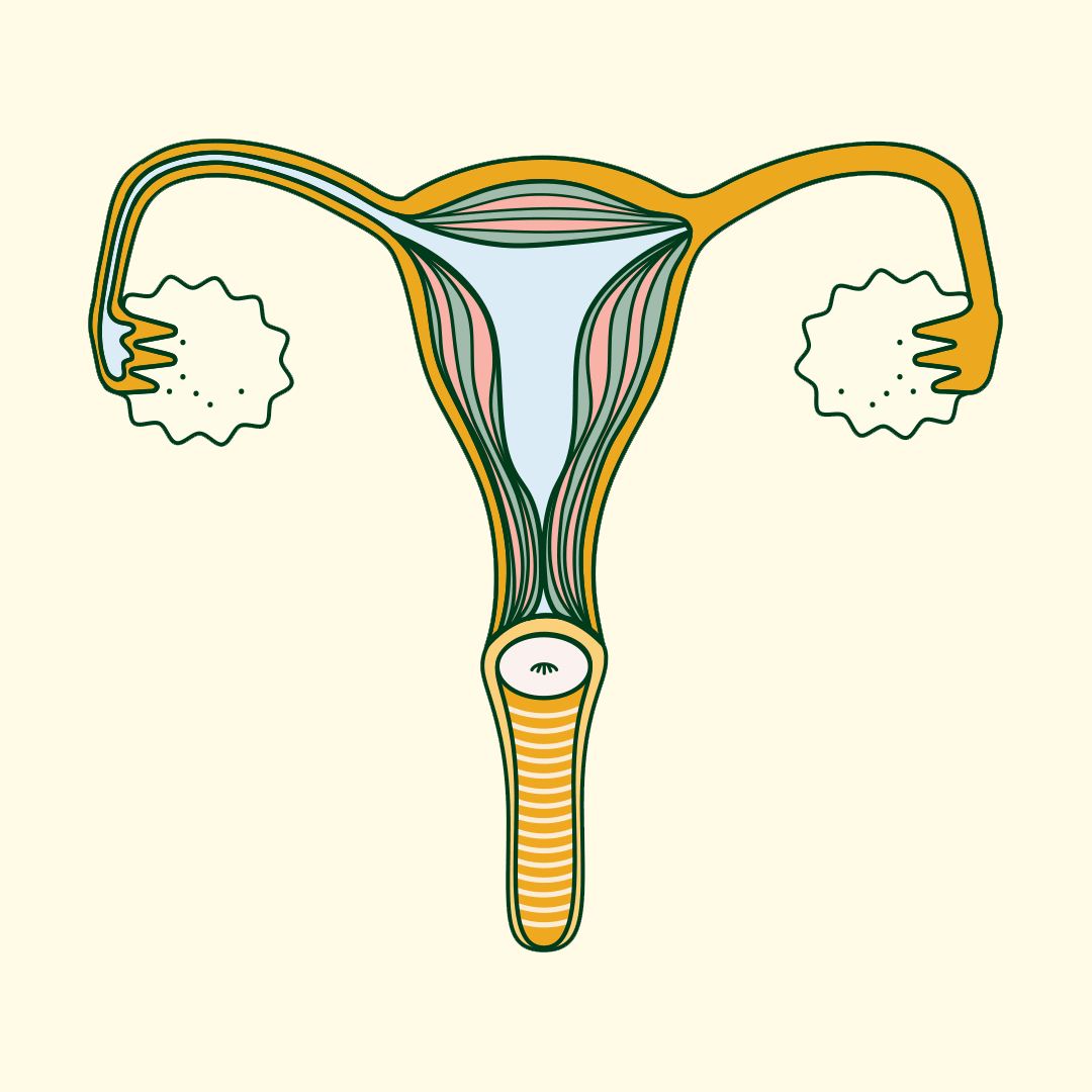 Endometriosis symptoms 