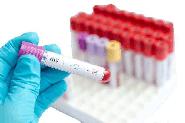 hiv-test-prevention