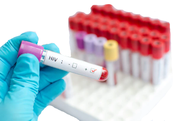 hiv-test-prevention