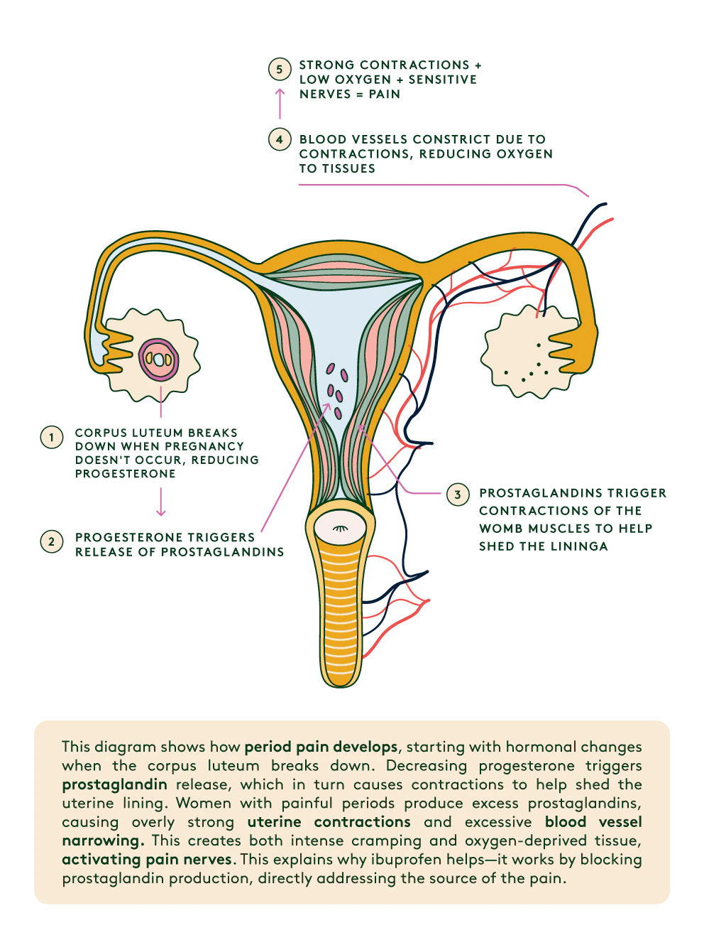 period-pain-infographic