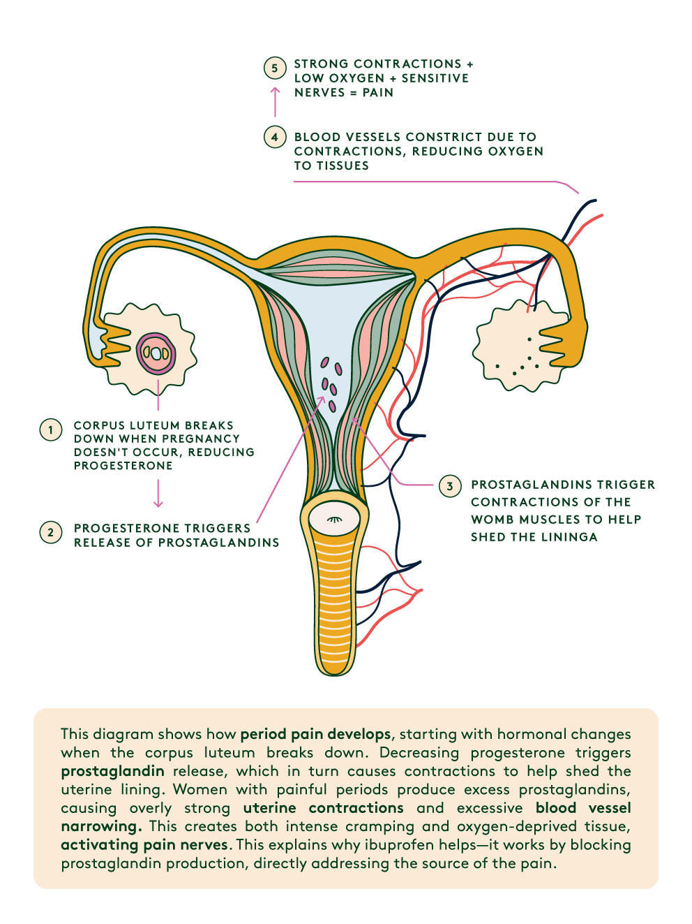 period-pain-infographic