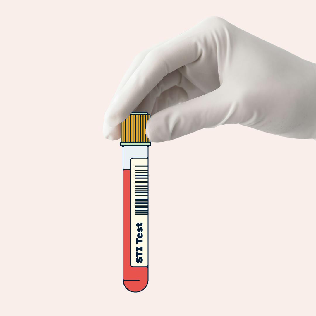 A person holding a sample container.