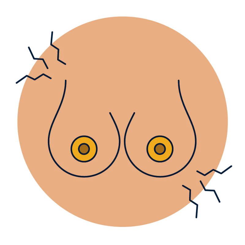 Aching breasts.