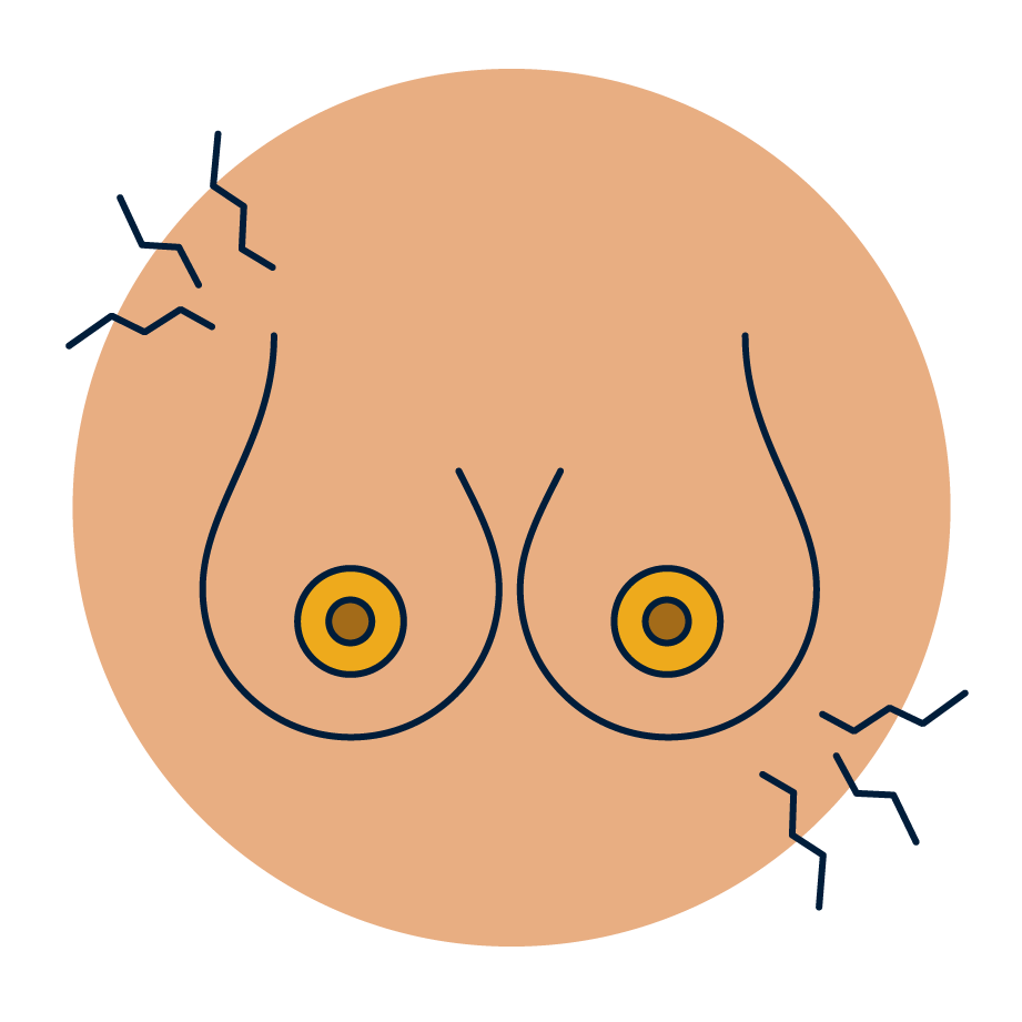 Aching breasts.