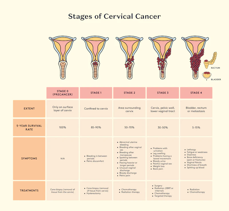 Stages of cancer, 5-year survival rate and symptoms.