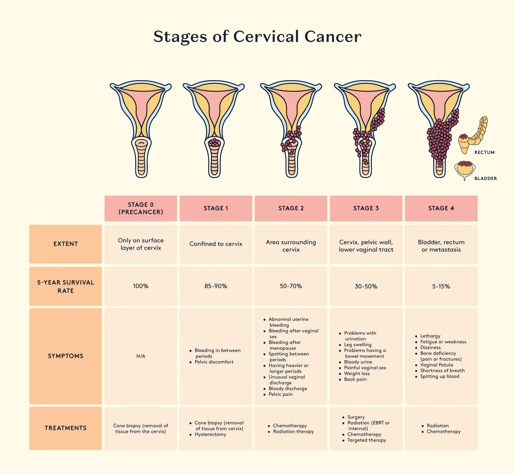 Stages of cancer, 5-year survival rate and symptoms.