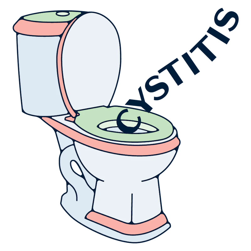 cystitis illustration