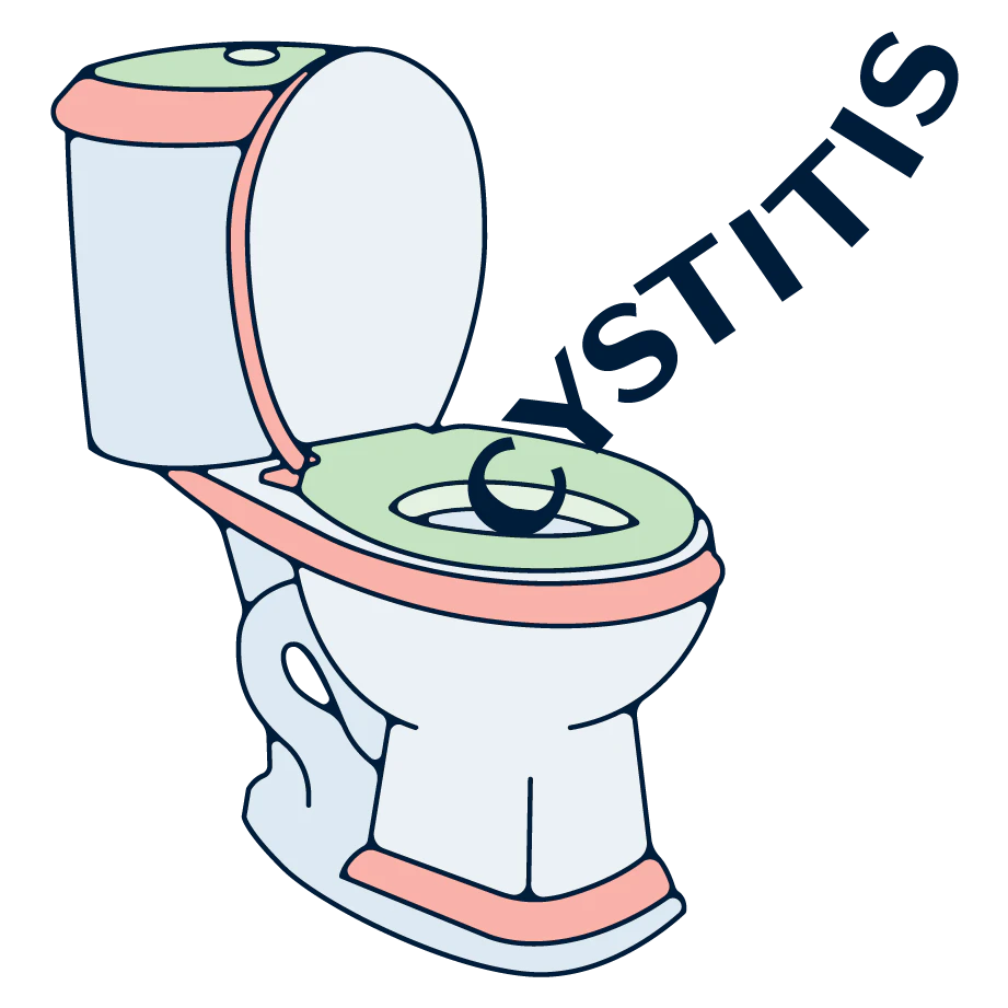 cystitis illustration