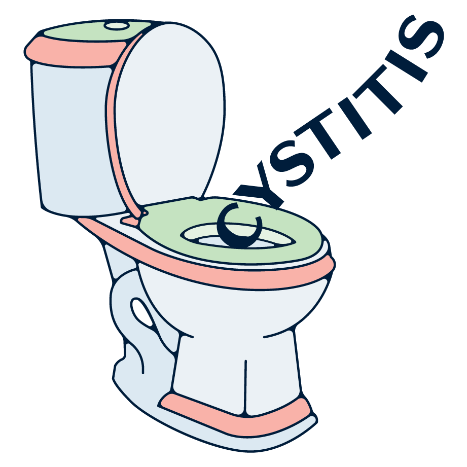 cystitis illustration