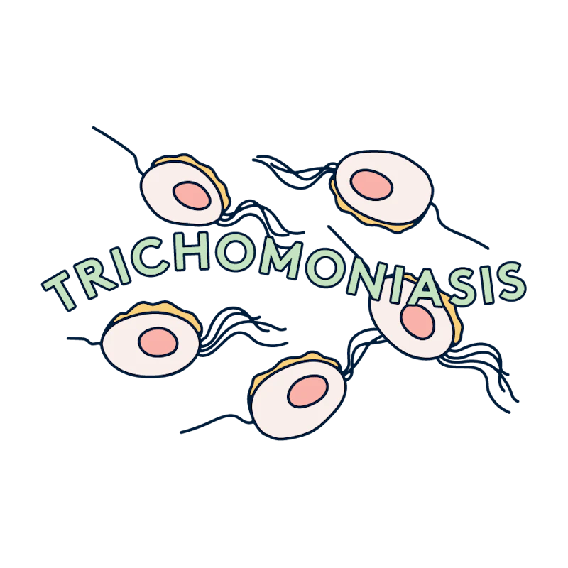 trichonomiasis illustration