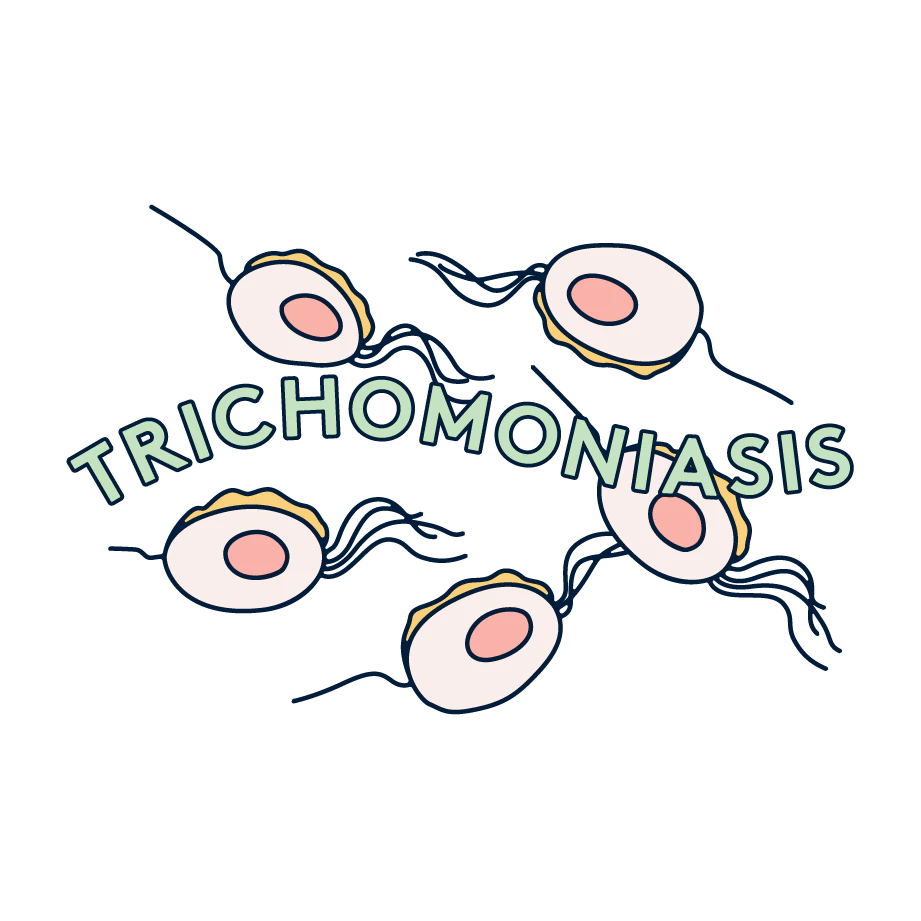 trichonomiasis illustration