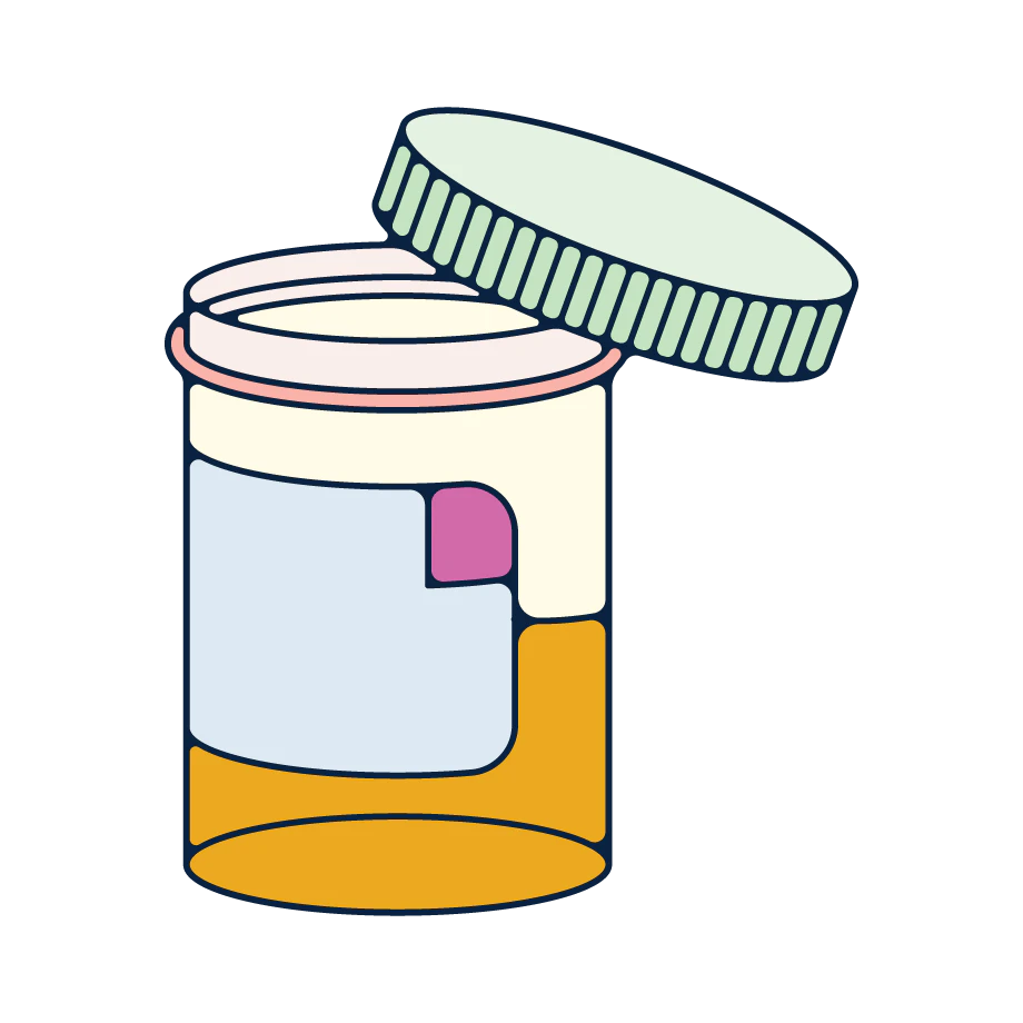 urine-sample-illustration