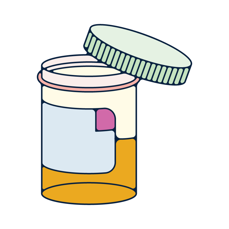 urine-sample-illustration